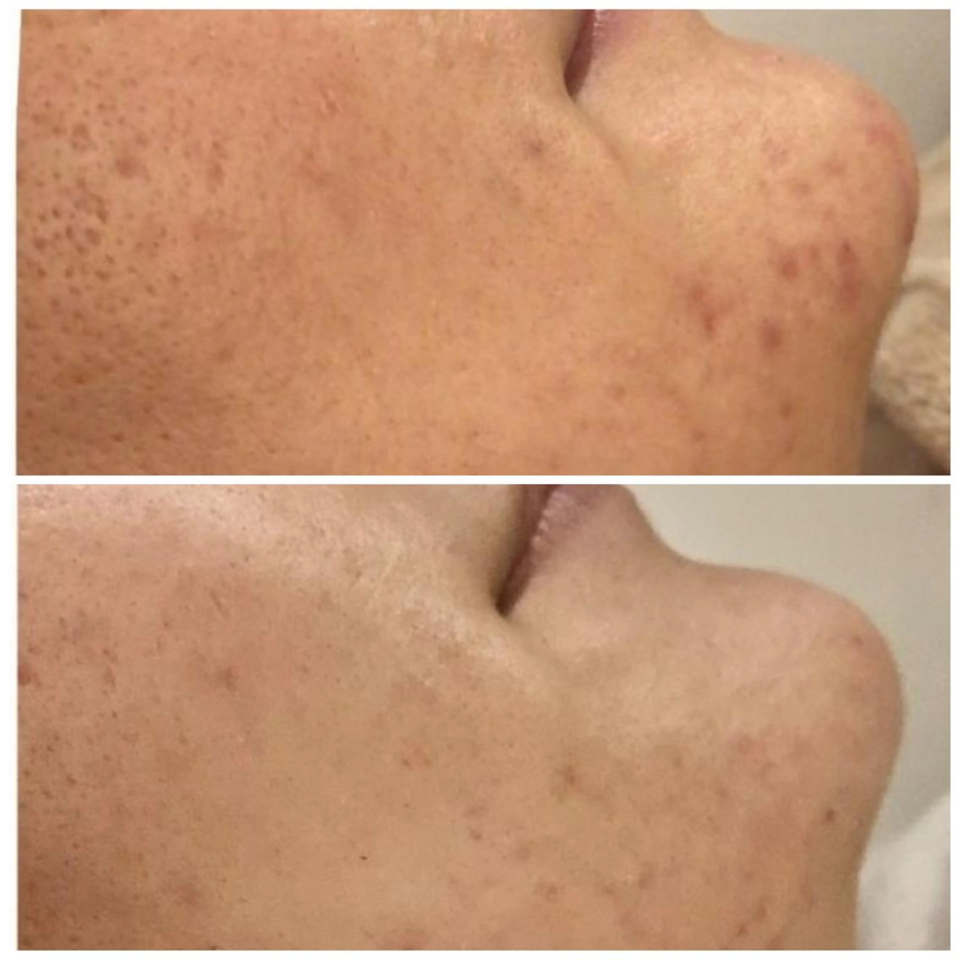 セミロング カラー パーマ ヘアアレンジ メンズ キッズ ネイル マツエク・マツパ アイブロウ 3か月で肌革命👼 ニキビ専門店💫のエステ・リラクイメージ