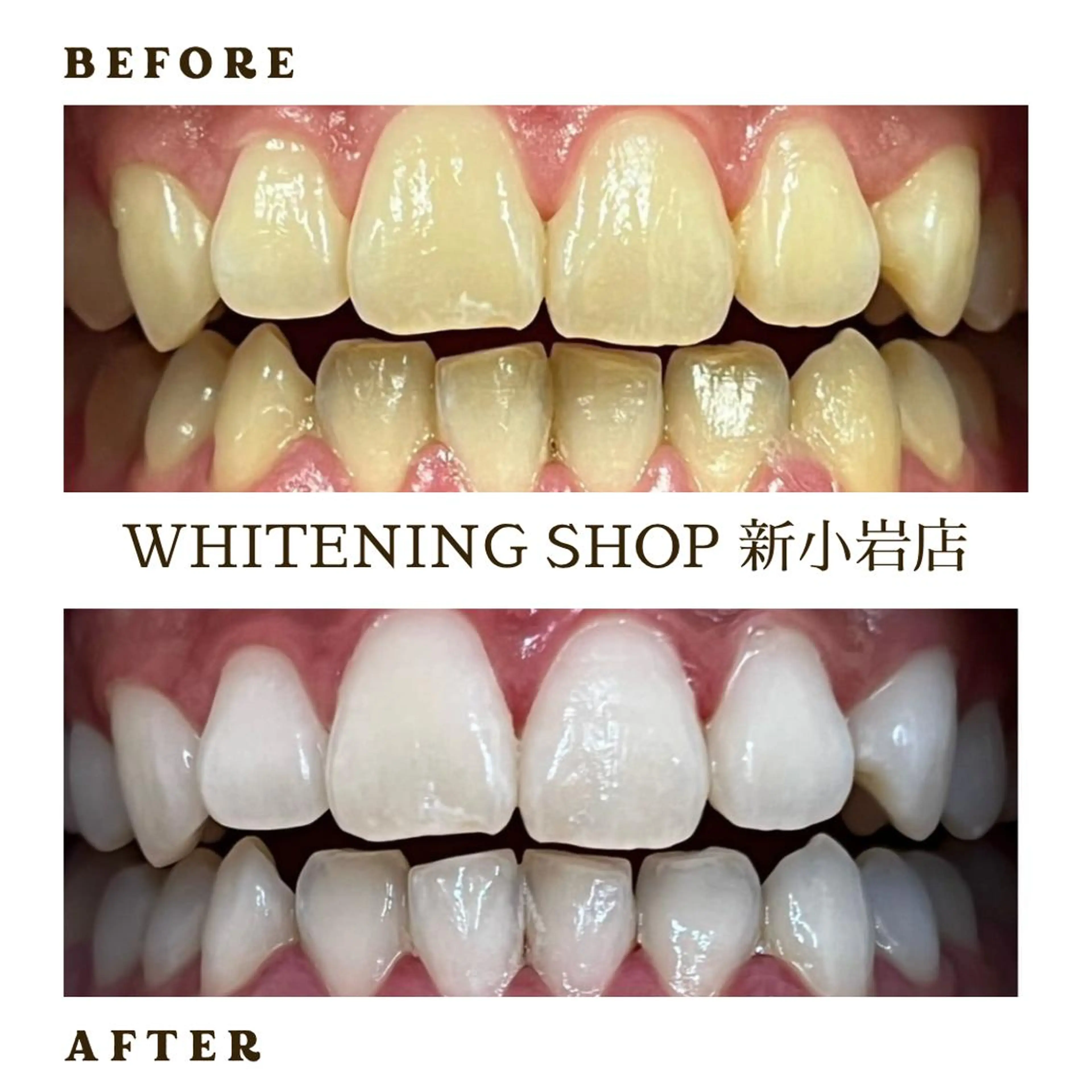 メンズ その他 ホワイトニング ショップ新小岩店のその他イメージ