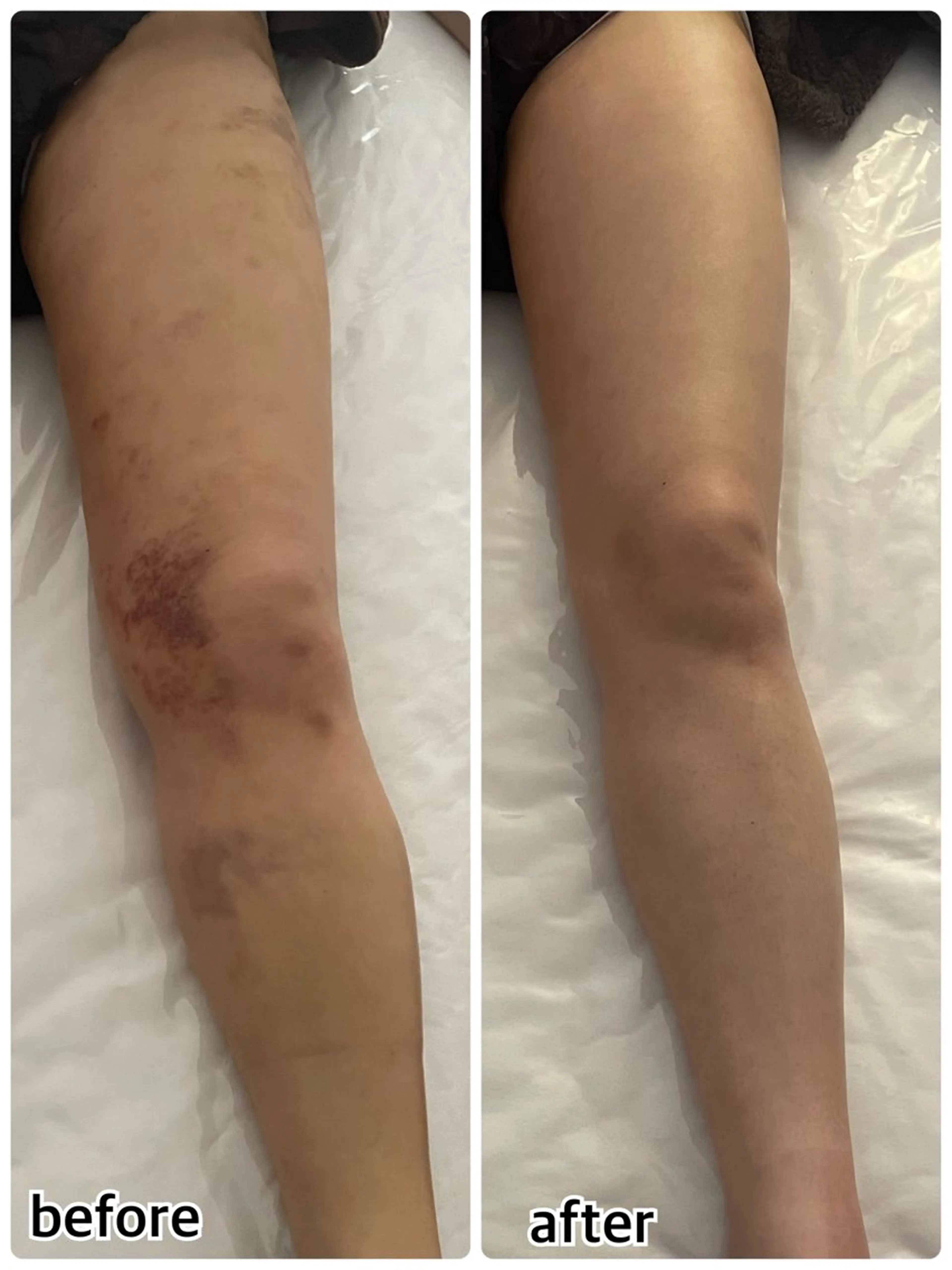 💎 GEM💎のエステ・リラクイメージ