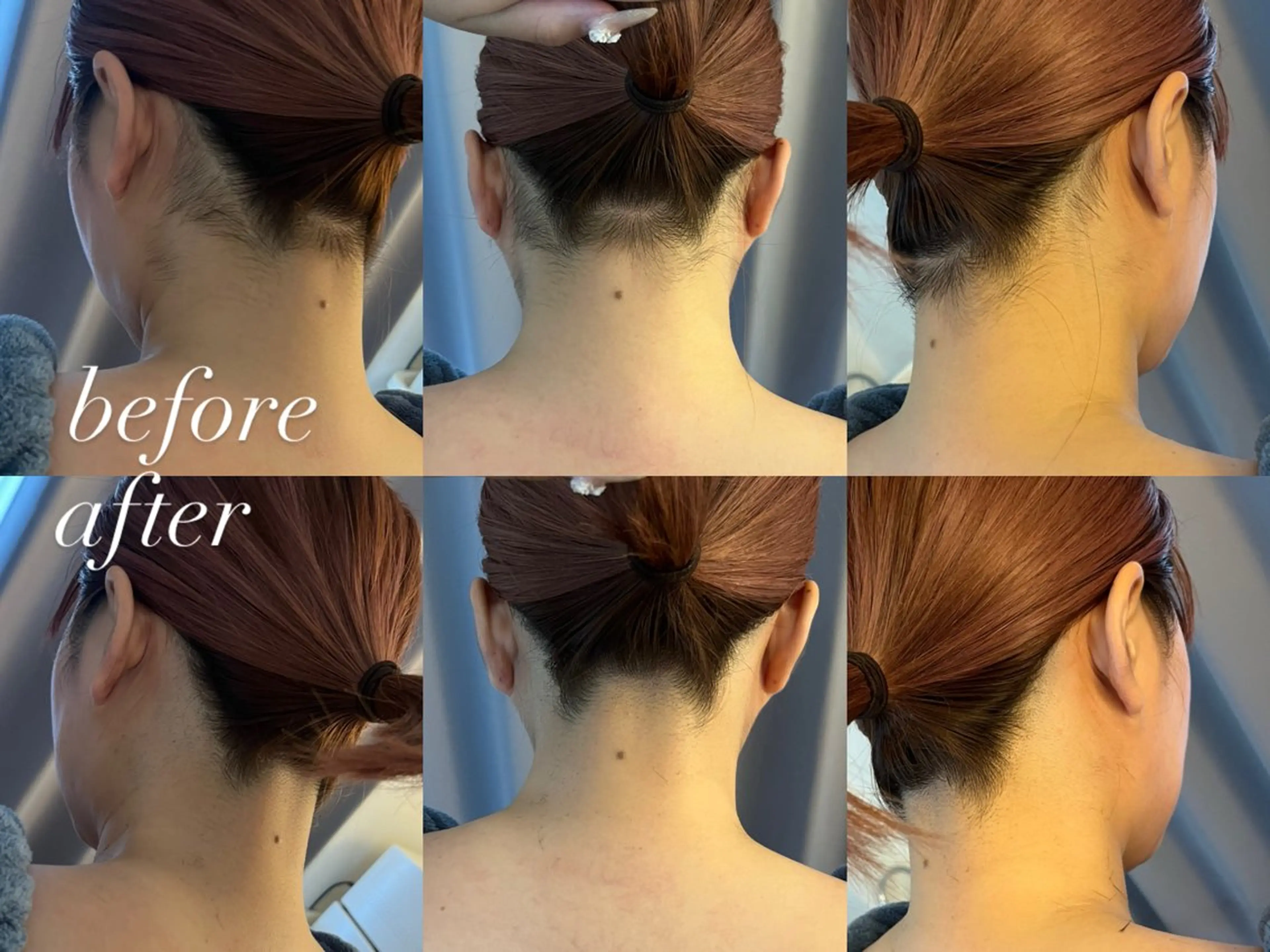 うなじ脱毛/美肌脱毛 LABELのエステ・リラクイメージ