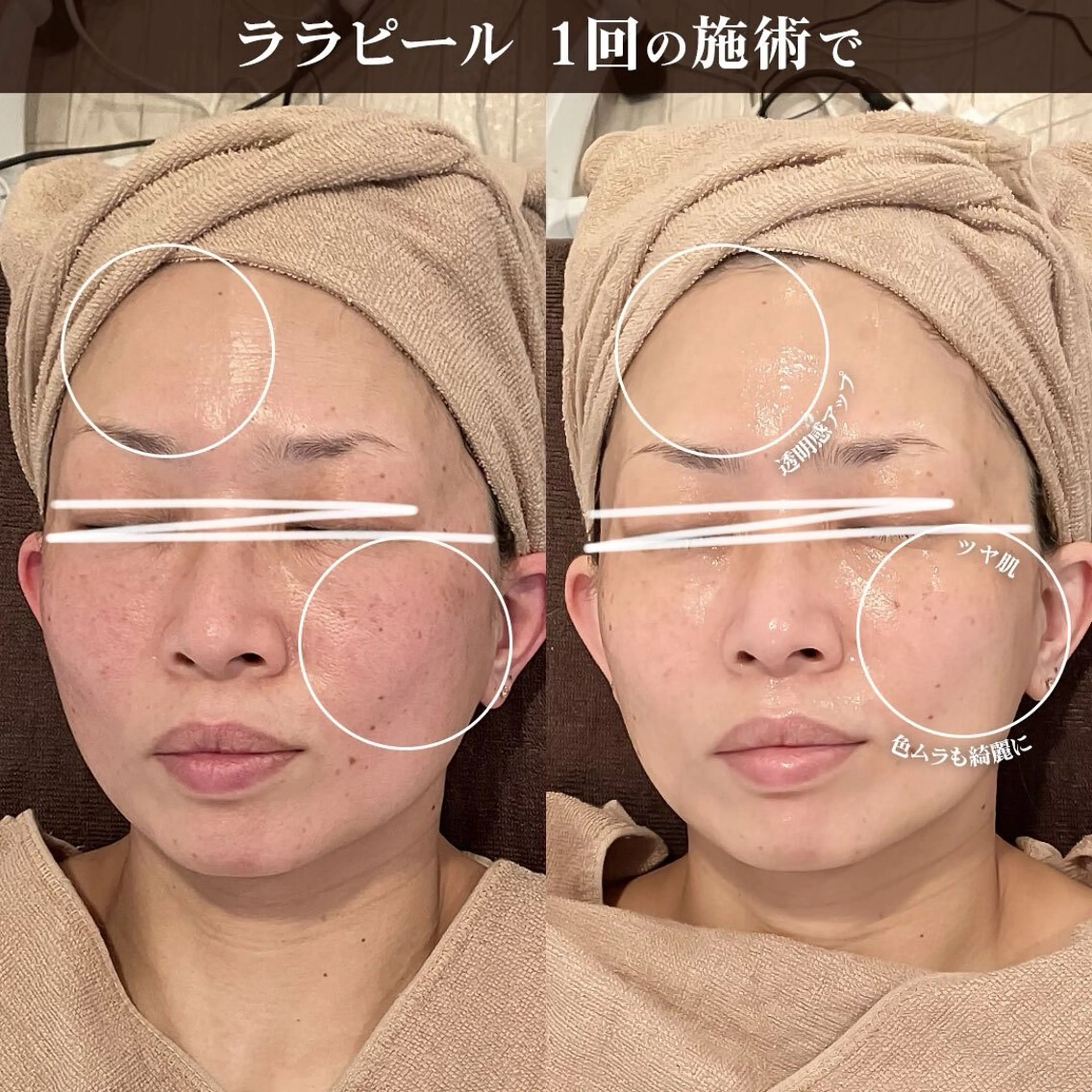 エステ トータルビューティー サロンキノセ折井のエステ・リラクイメージ