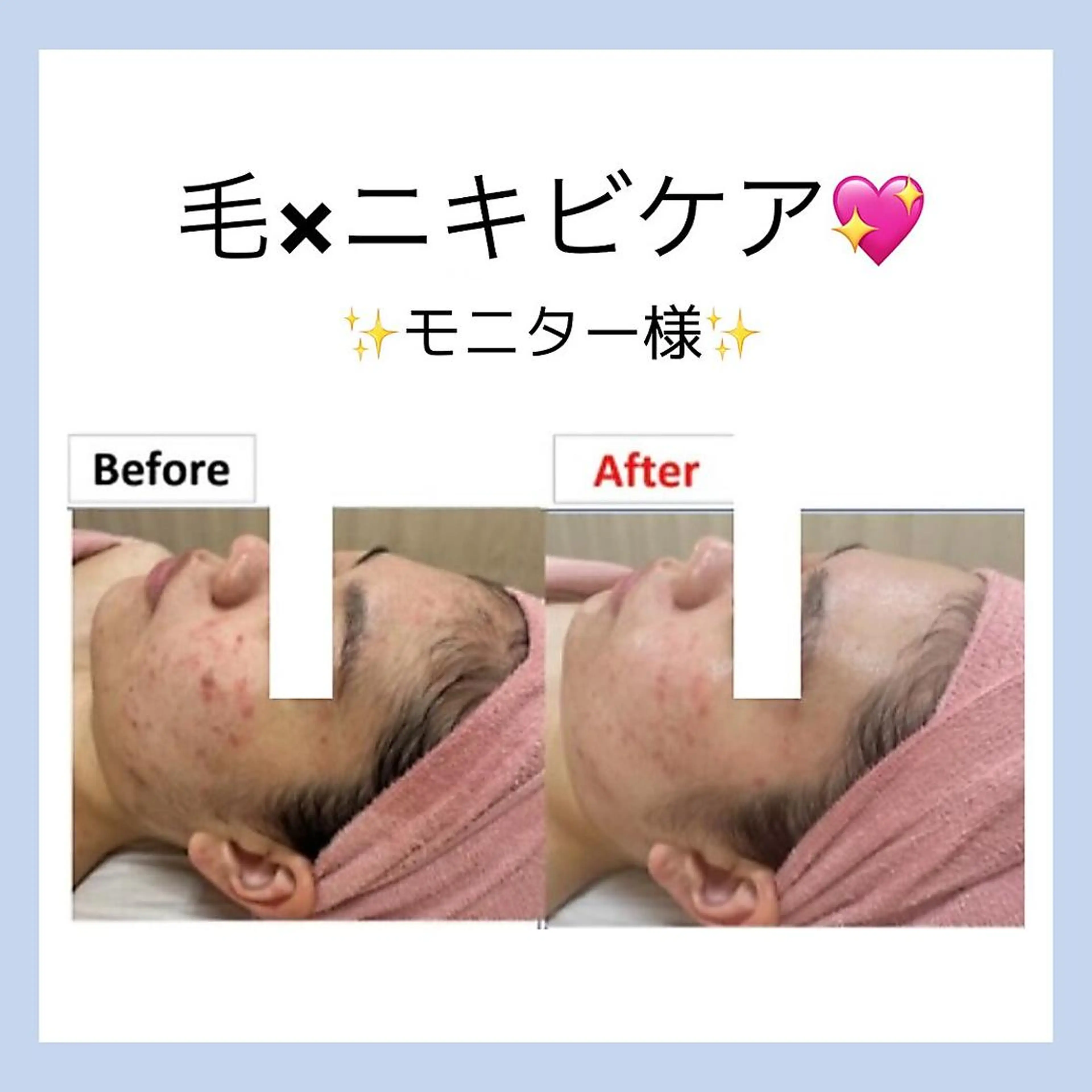 バスト専門店 RAYVIS🌺髙田のエステ・リラクイメージ