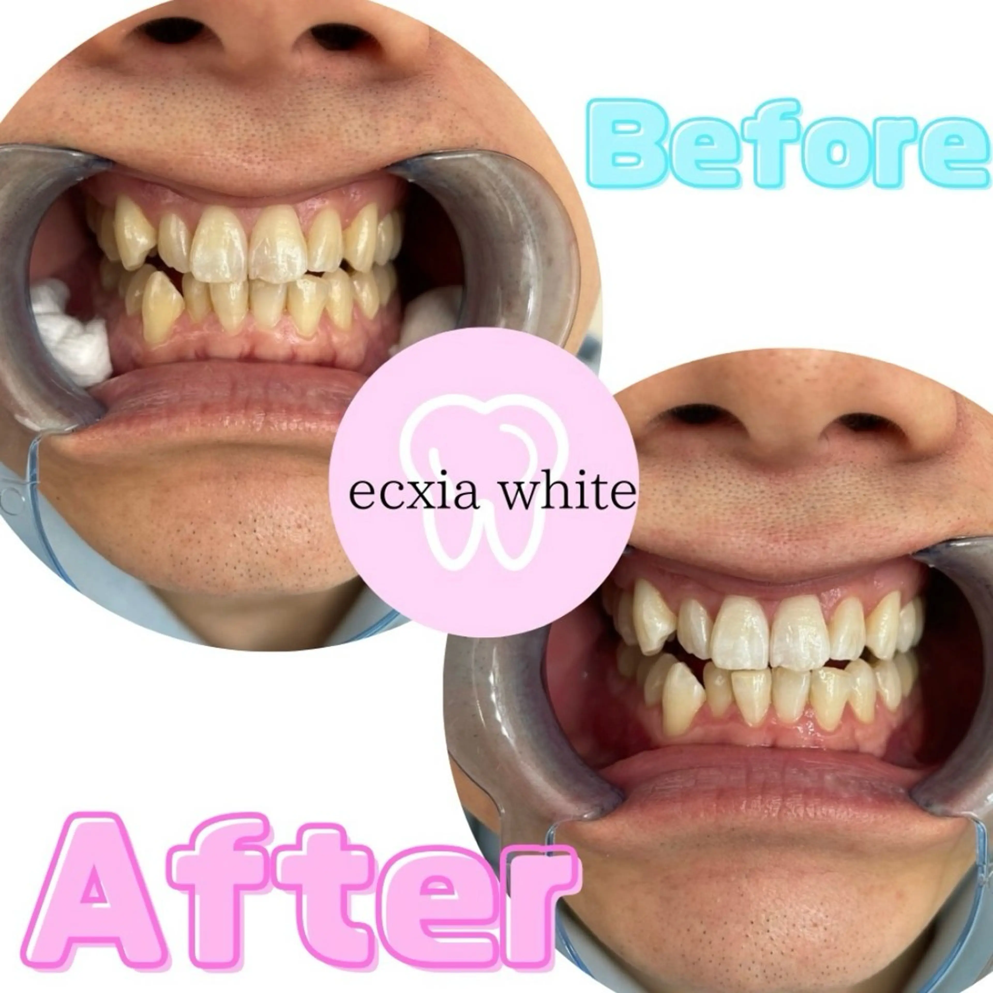 セルフホワイトニング エクシア前橋店のその他イメージ