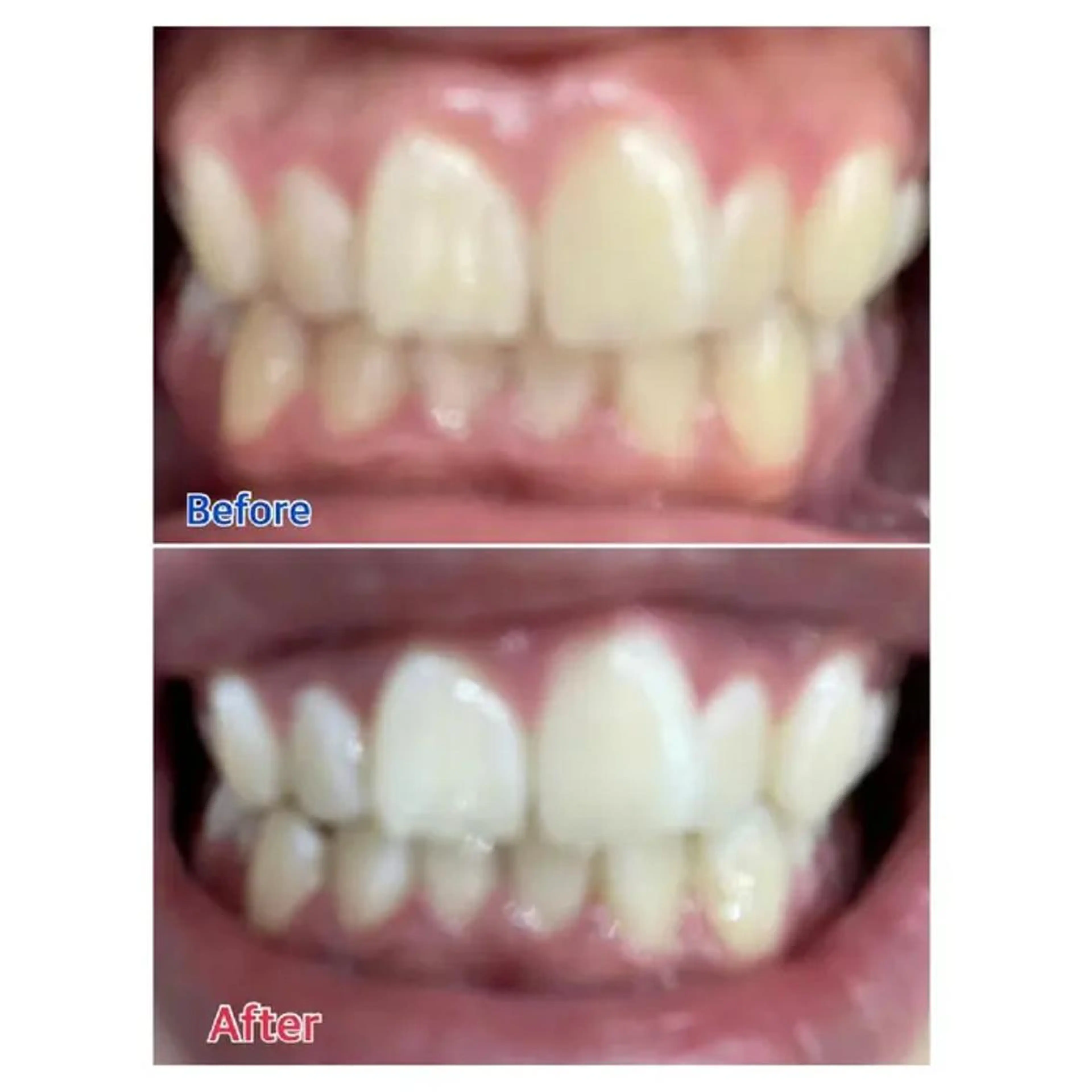 M渋谷 ホワイトニングのエステ・リラクイメージ