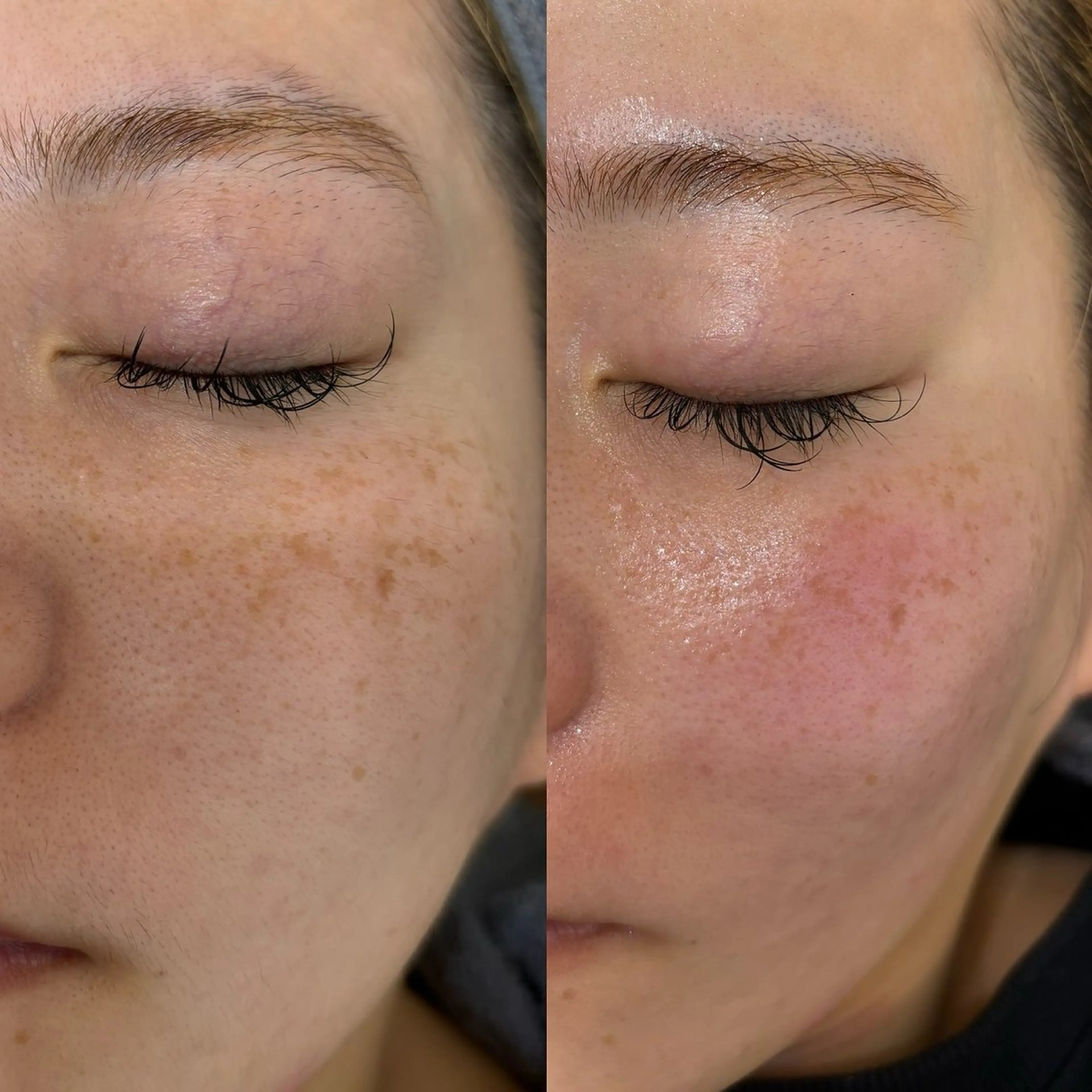 西脇 有紀のエステ・リラクイメージ