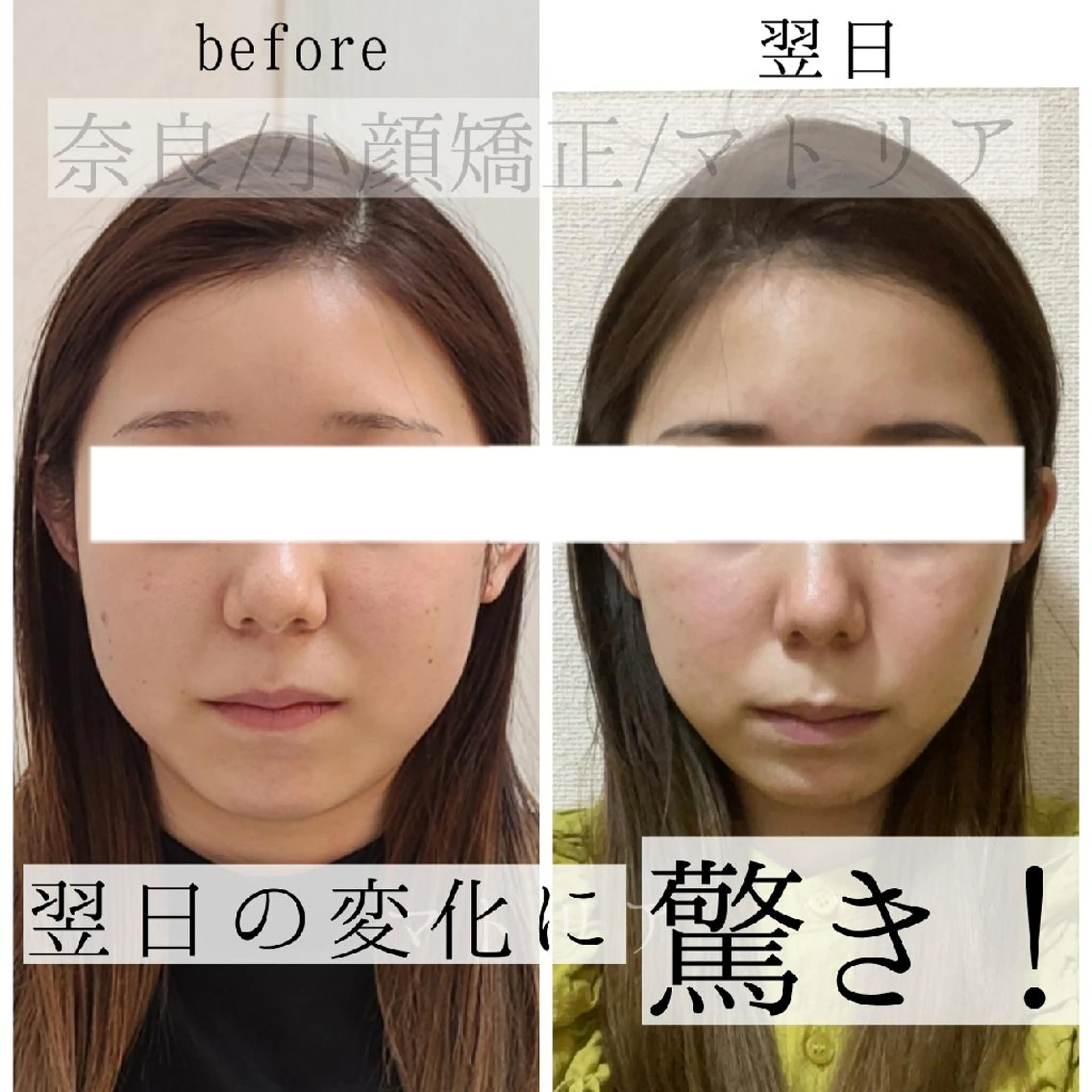 エステ 小顔 美肌専門 Matoriaのエステ・リラクイメージ