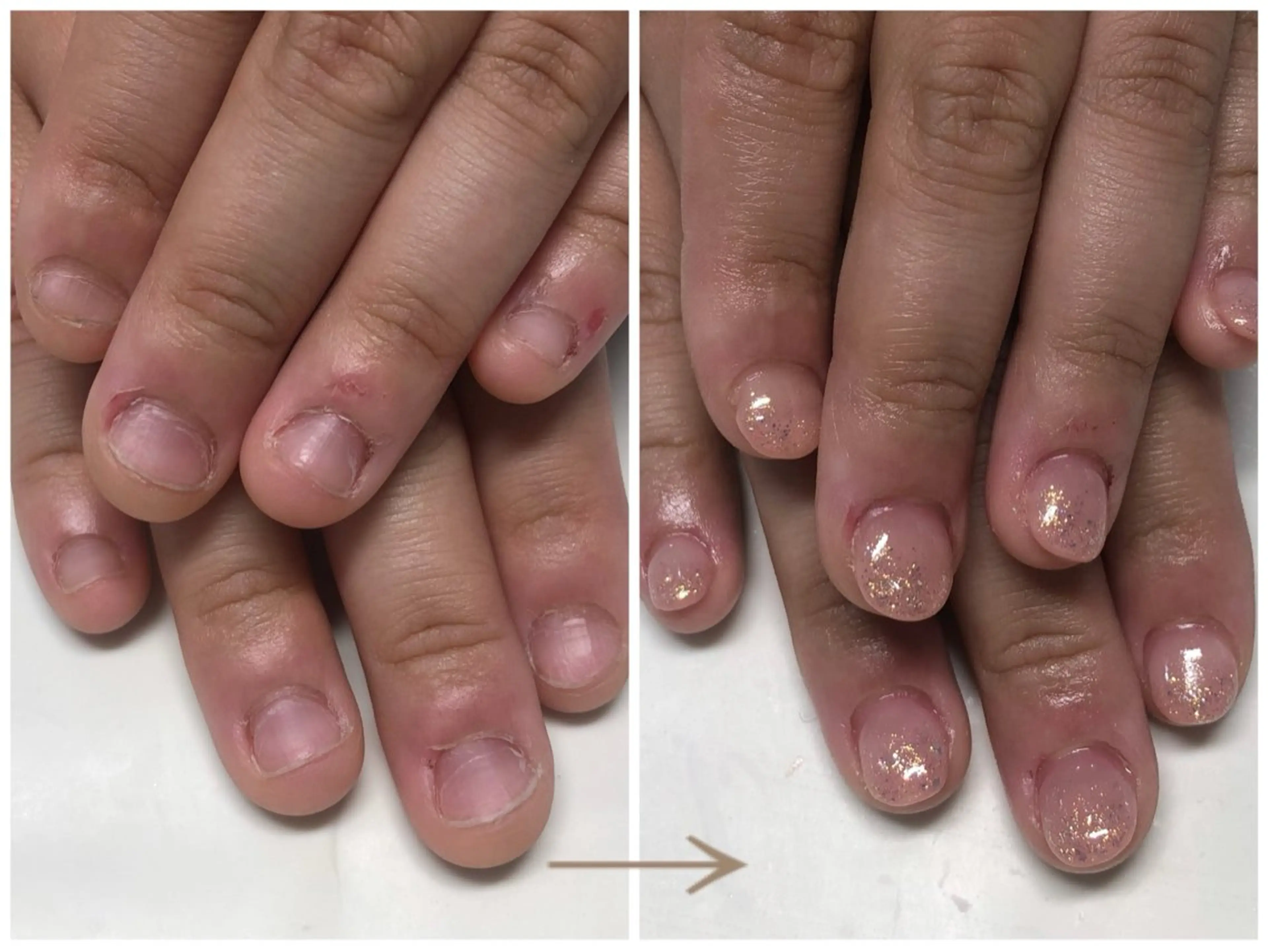 ネイル グラデーション キラキラネイル ラメ(グリッター) ラメグラデーション ワンカラーネイル 深爪矯正・自爪育成 ヴェールリムのネイルデザイン