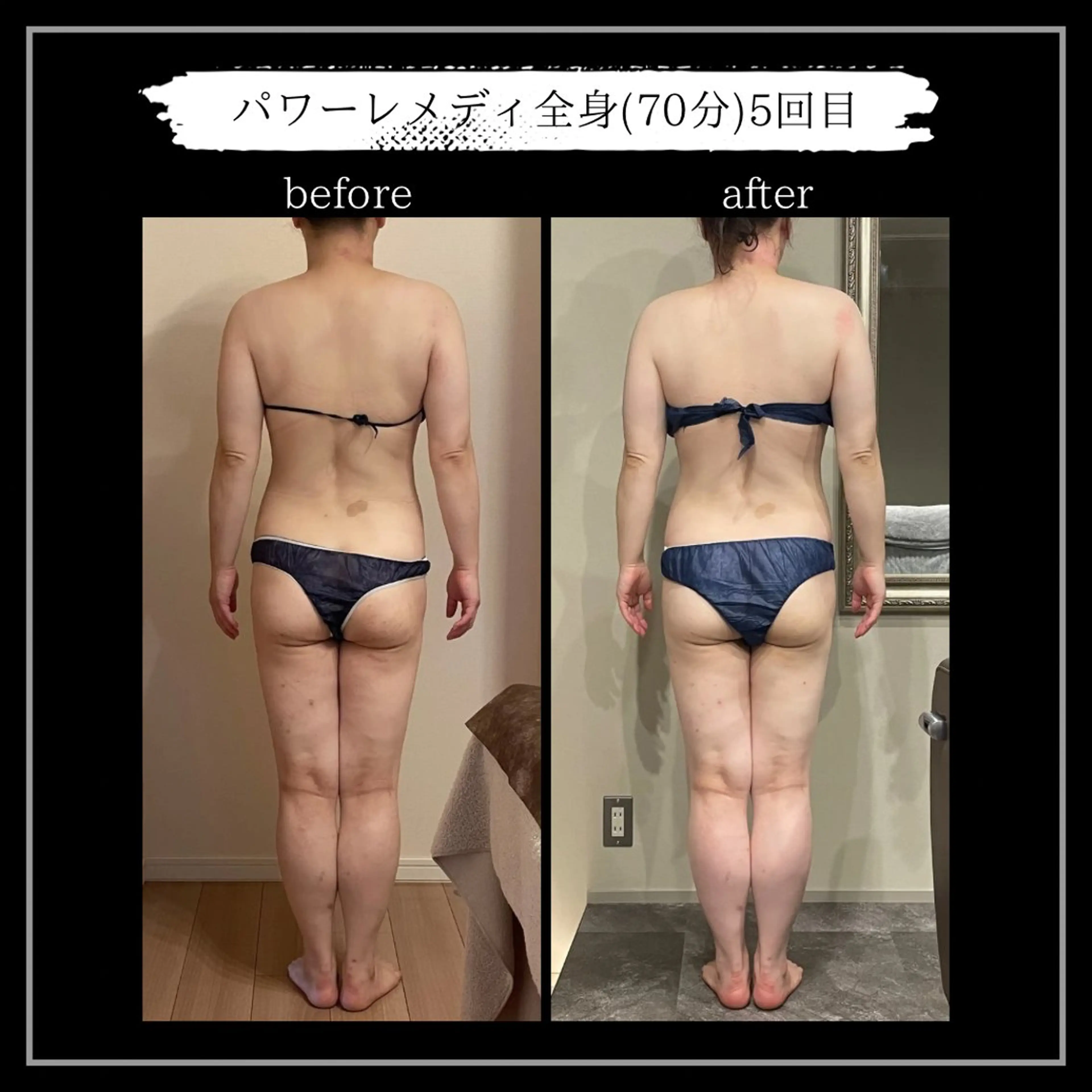 オフ:オン 全身筋膜マッサージのエステ・リラクイメージ