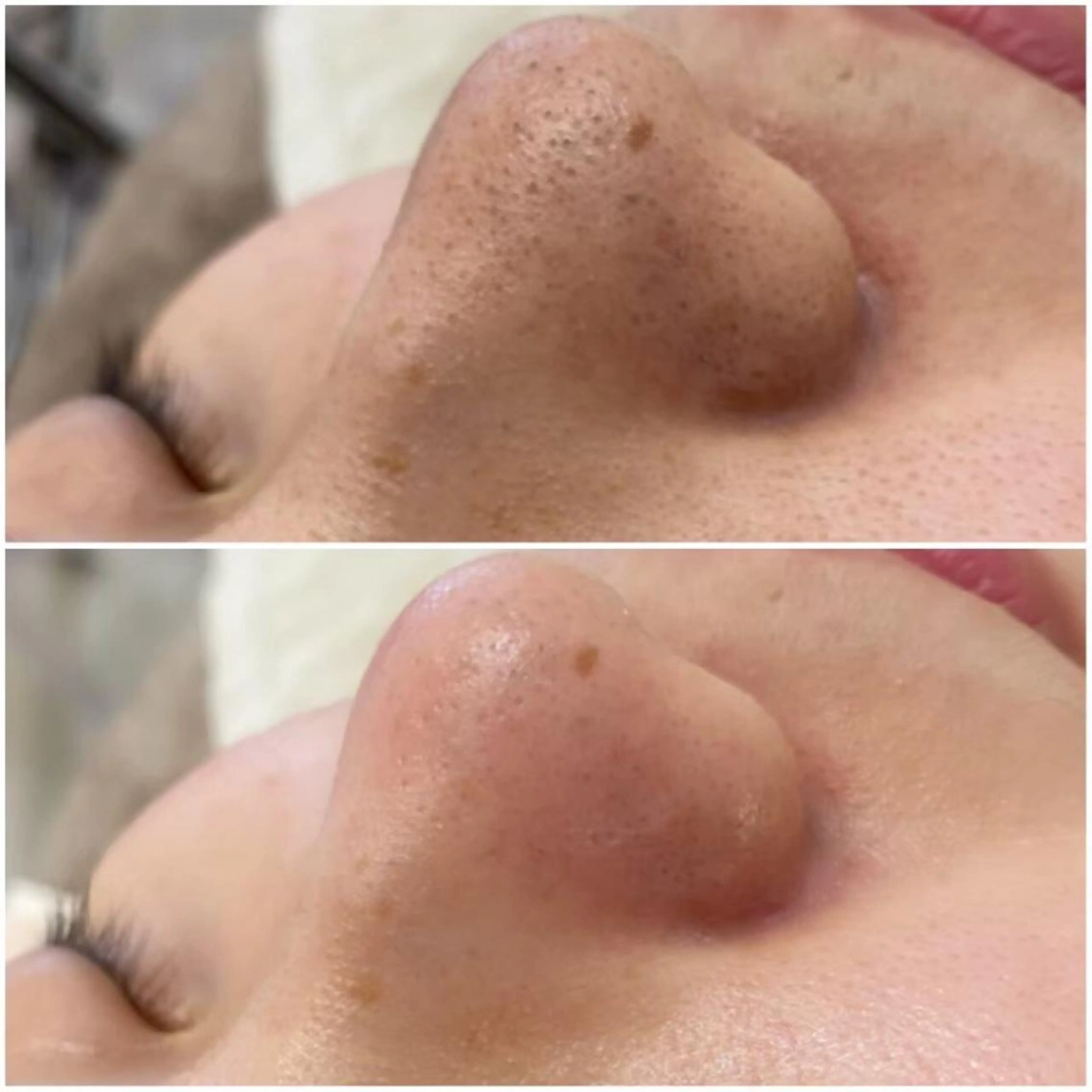 ララ/ハーブ メゾンリュバンのエステ・リラクイメージ