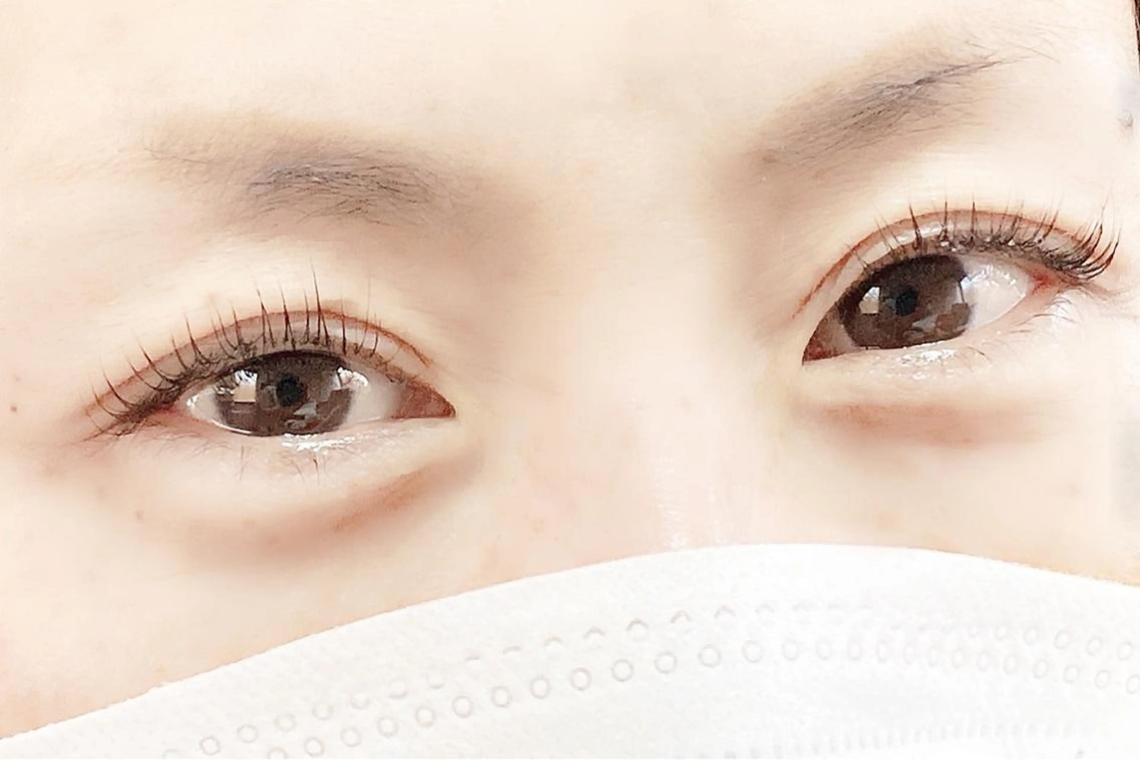 小顔矯正とまつ毛パーマでさらに目力アップの写真