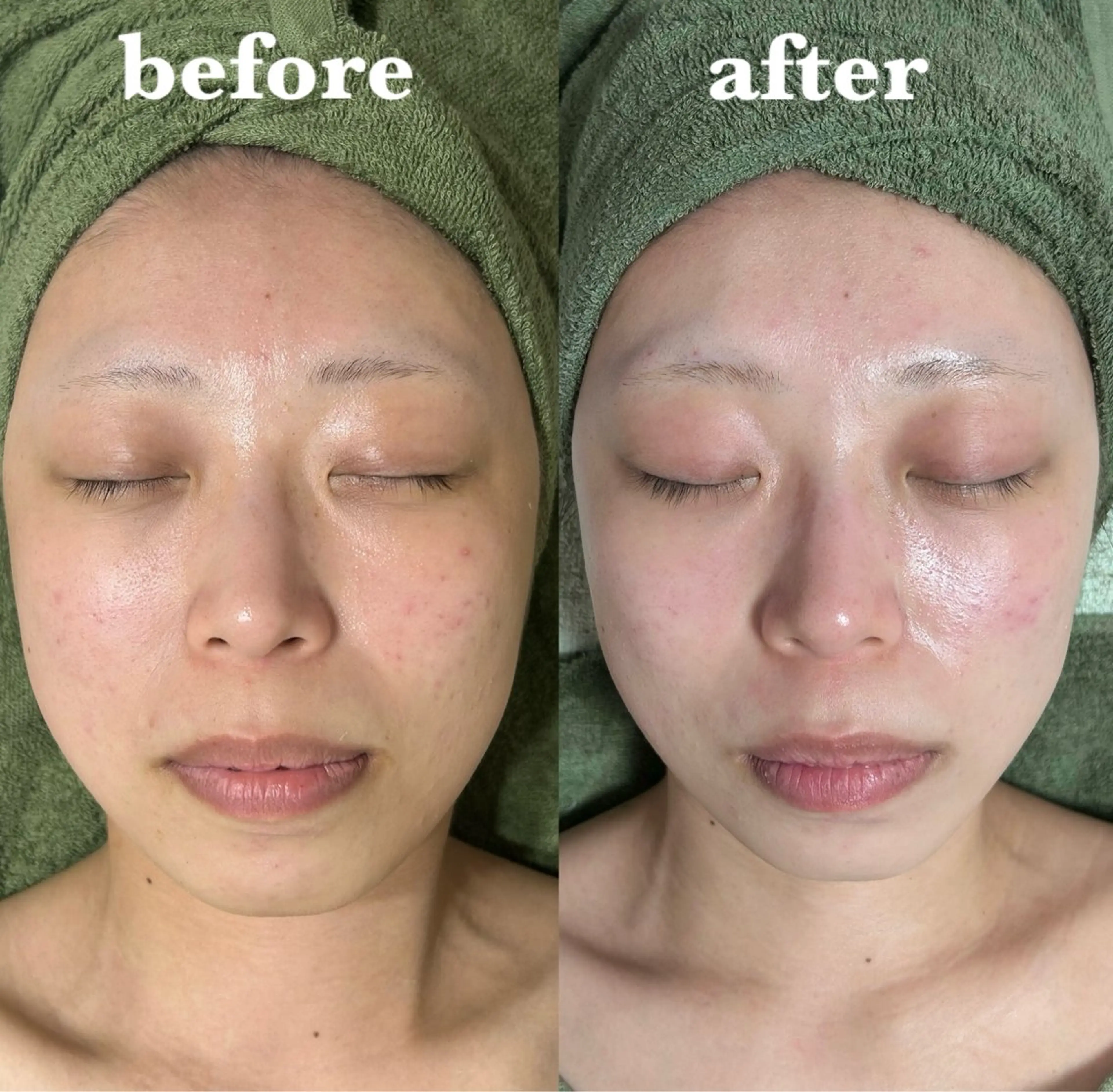 肌質改善＆脱毛 【M Mondo】のエステ・リラクイメージ