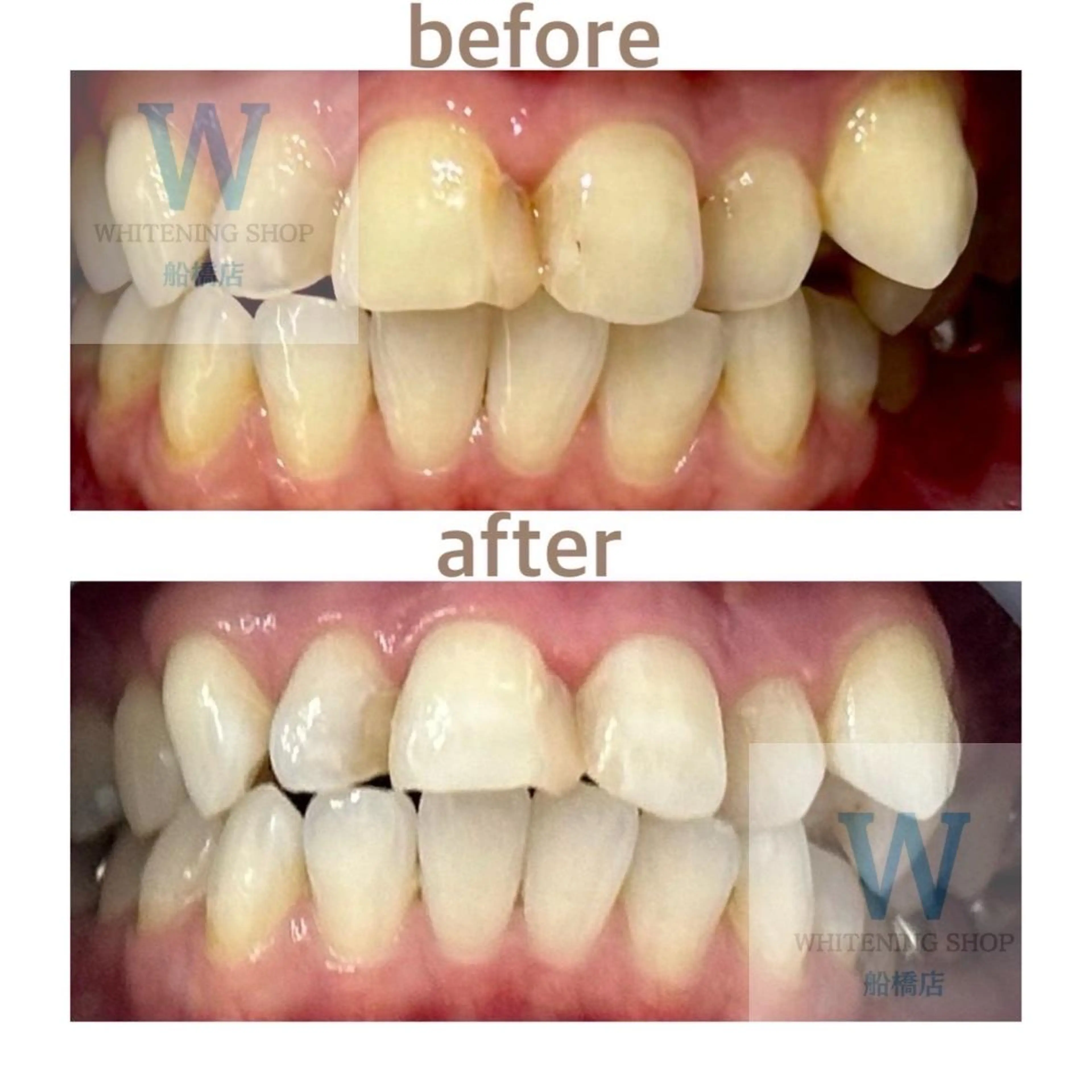 ホワイトニング ショップ船橋店🦷のエステ・リラクイメージ