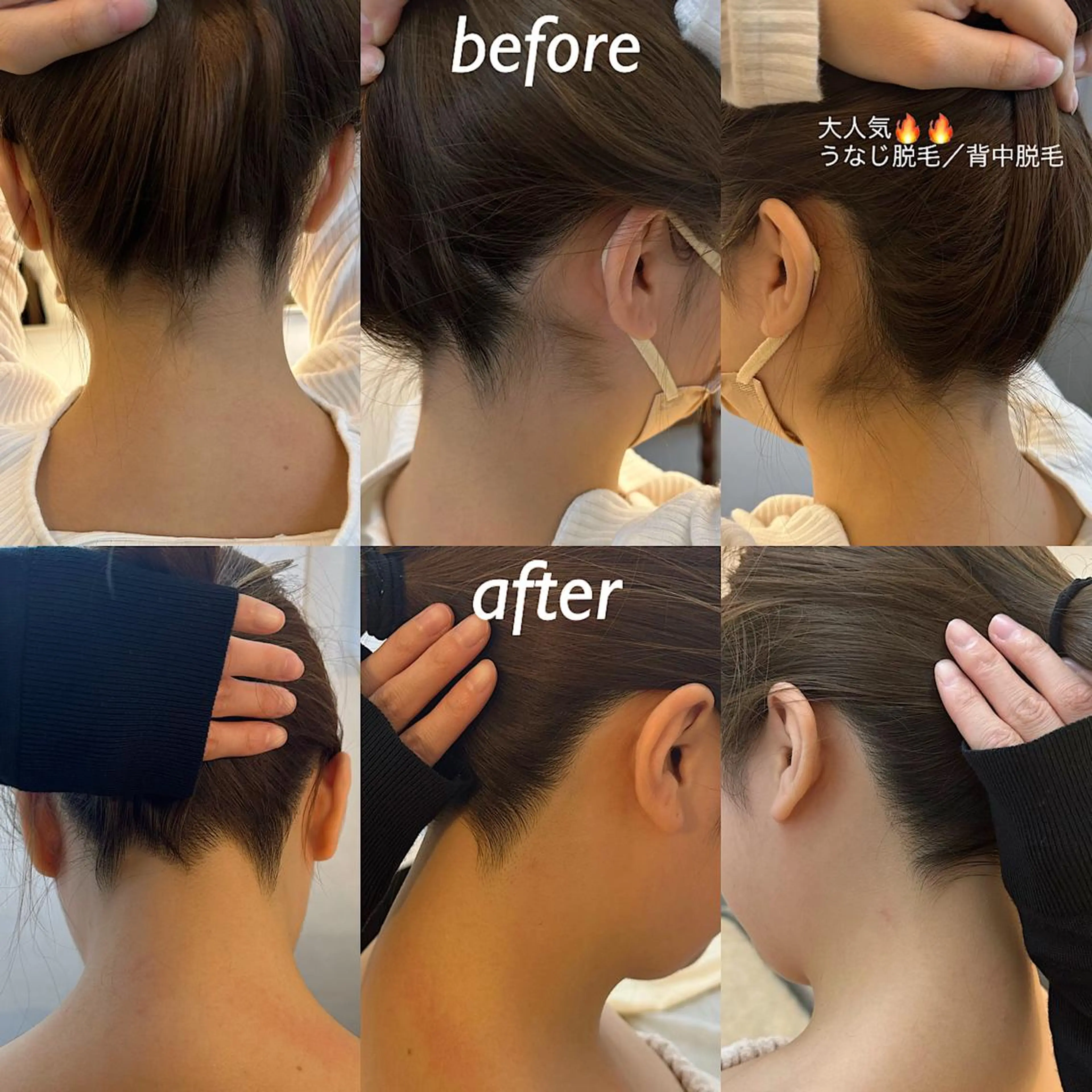 うなじ脱毛/美肌脱毛 LABELのエステ・リラクイメージ