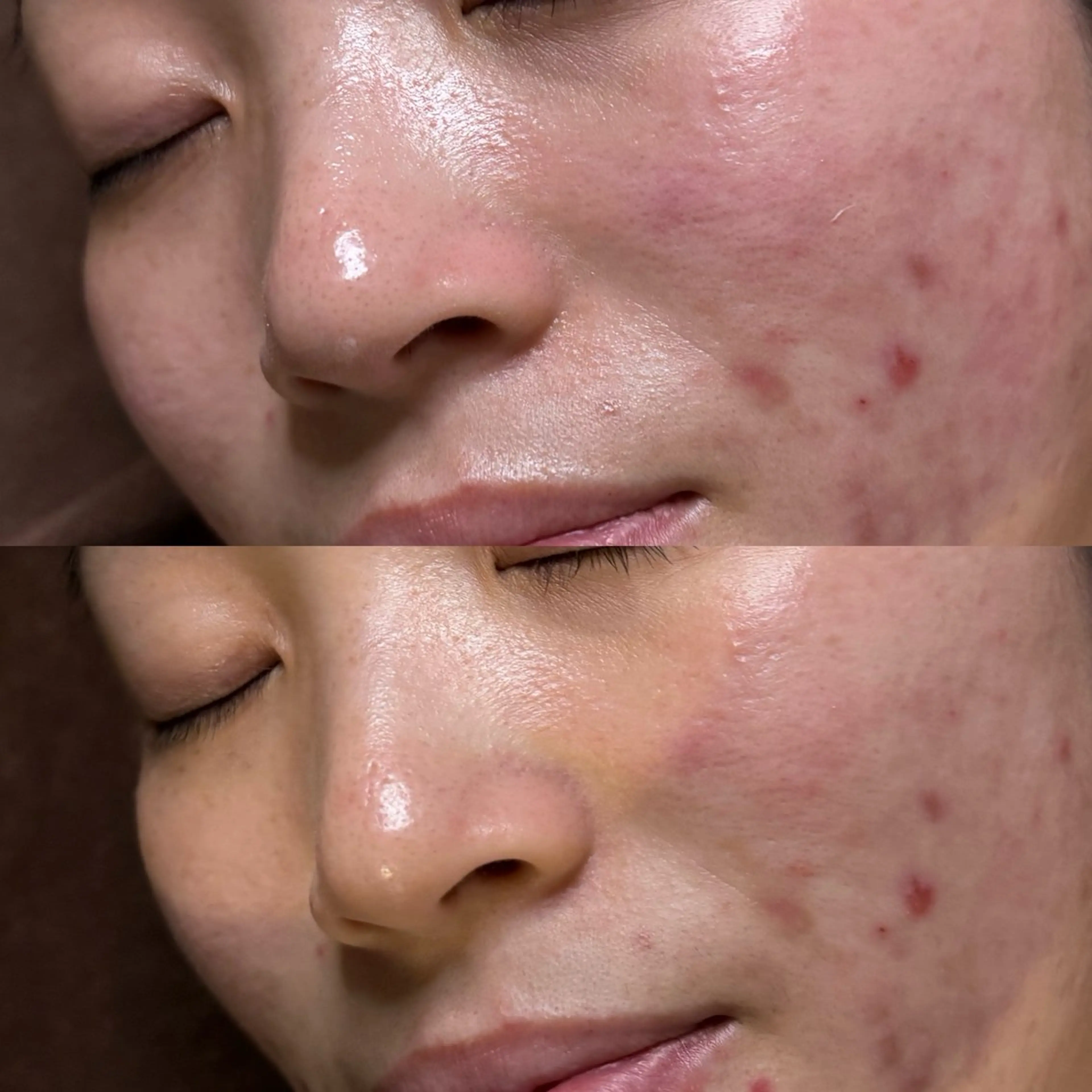 エステ 六本木脱毛andS 店長Sachiのエステ・リラクイメージ