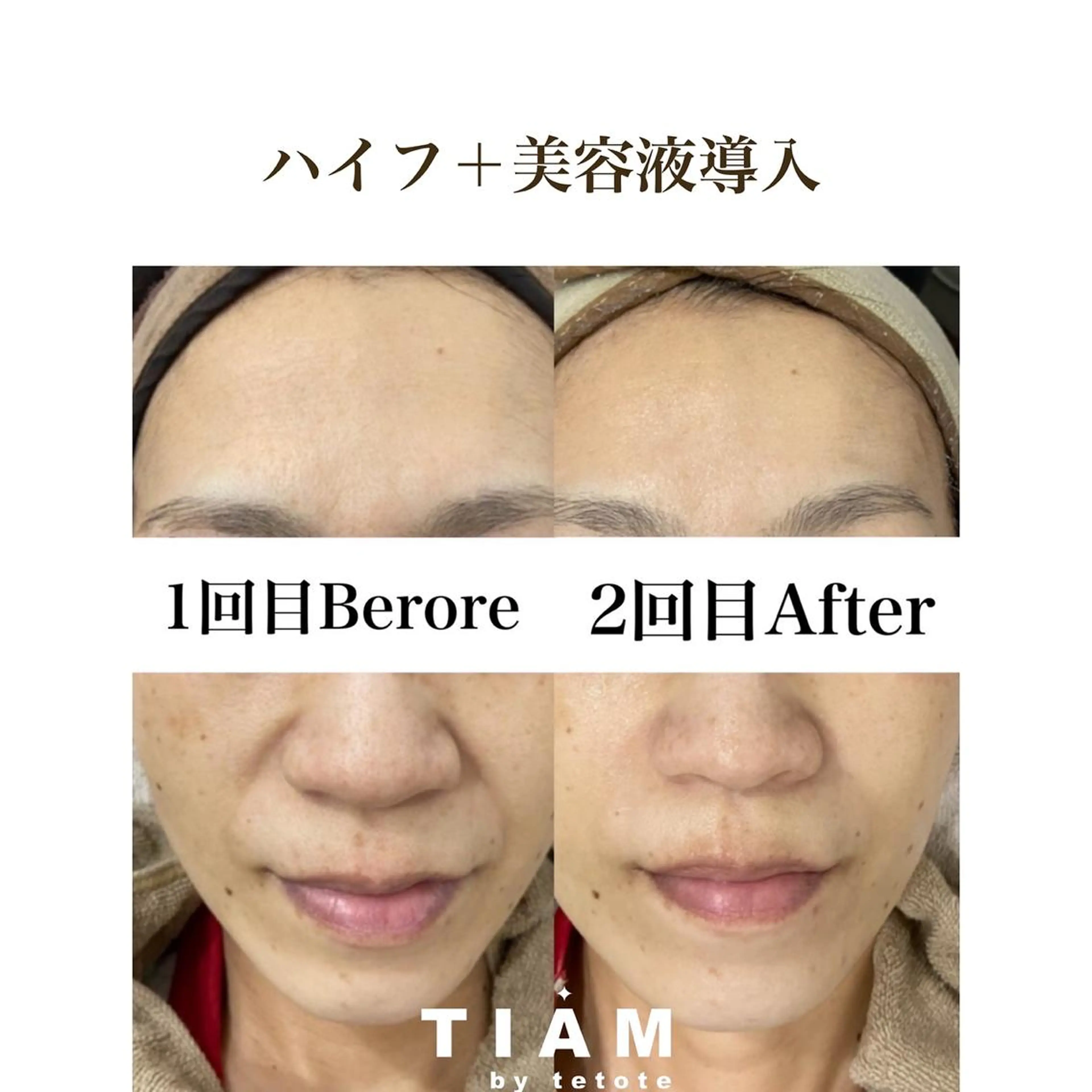 美肌サロンTIAM by tetoteのエステ・リラクイメージ