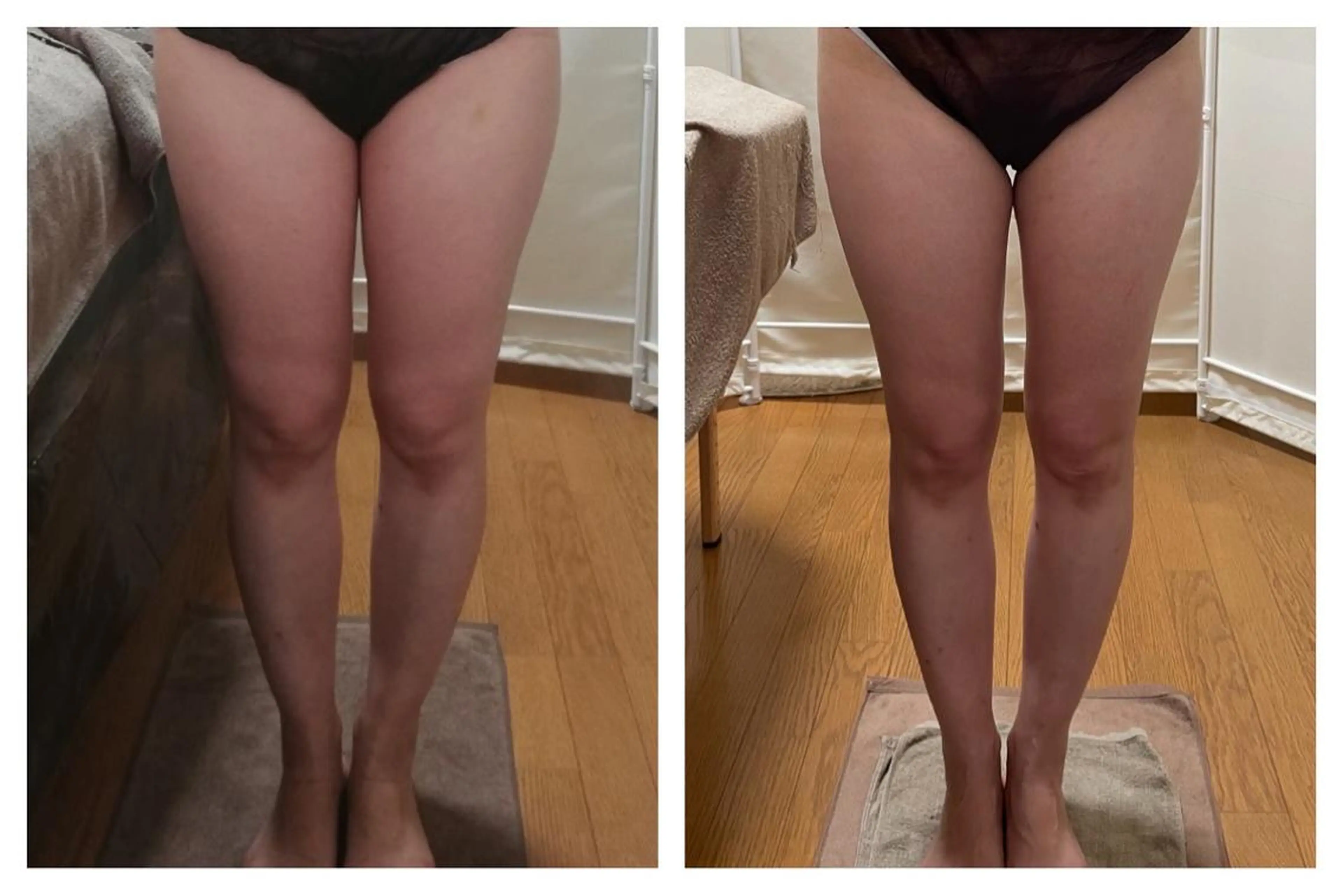 biloop所属・《本気痩せ×疲労改善 》  BILOOPのエステ・リラクイメージ