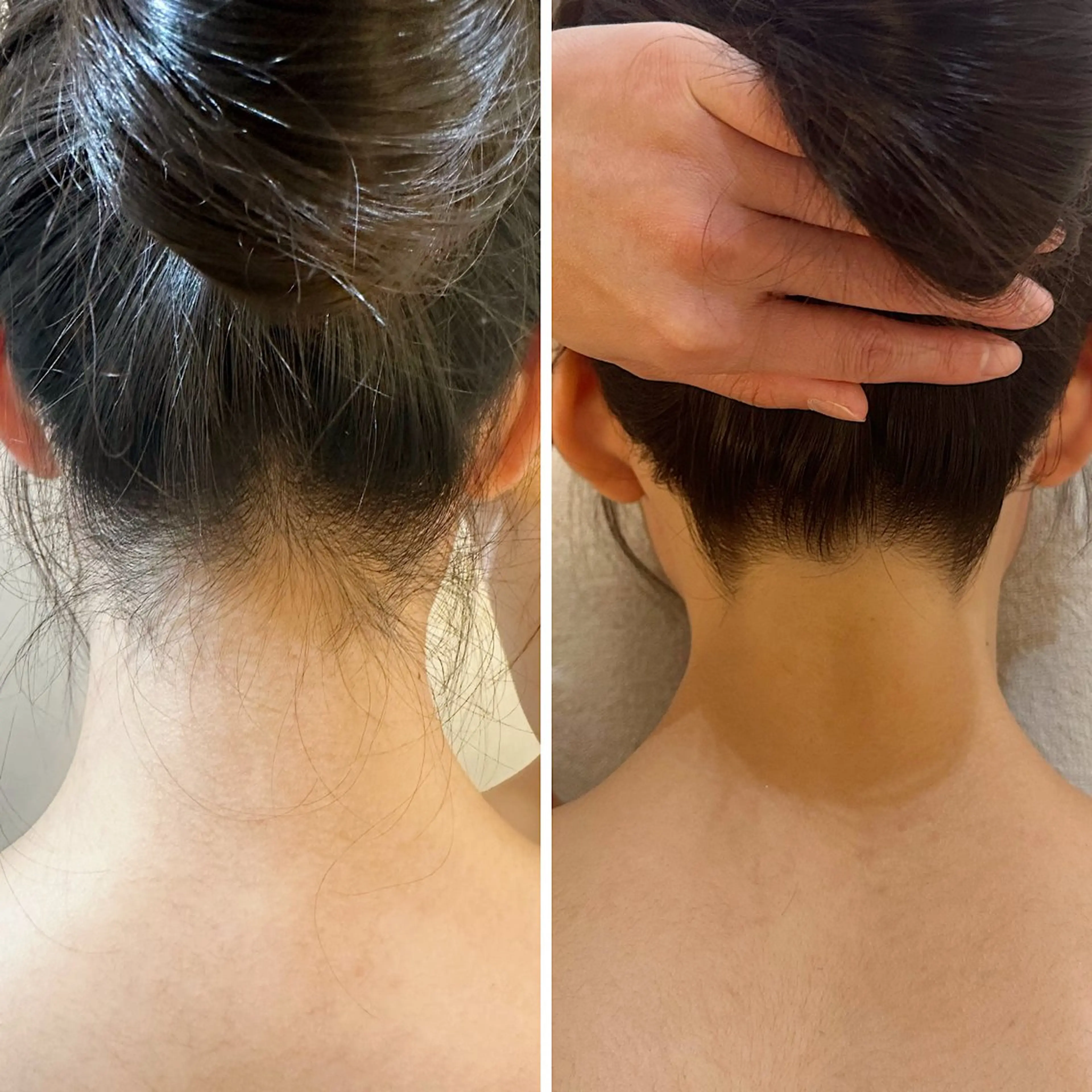 脱毛 うなじ脱毛/美肌脱毛 LABELのエステ・リラクイメージ