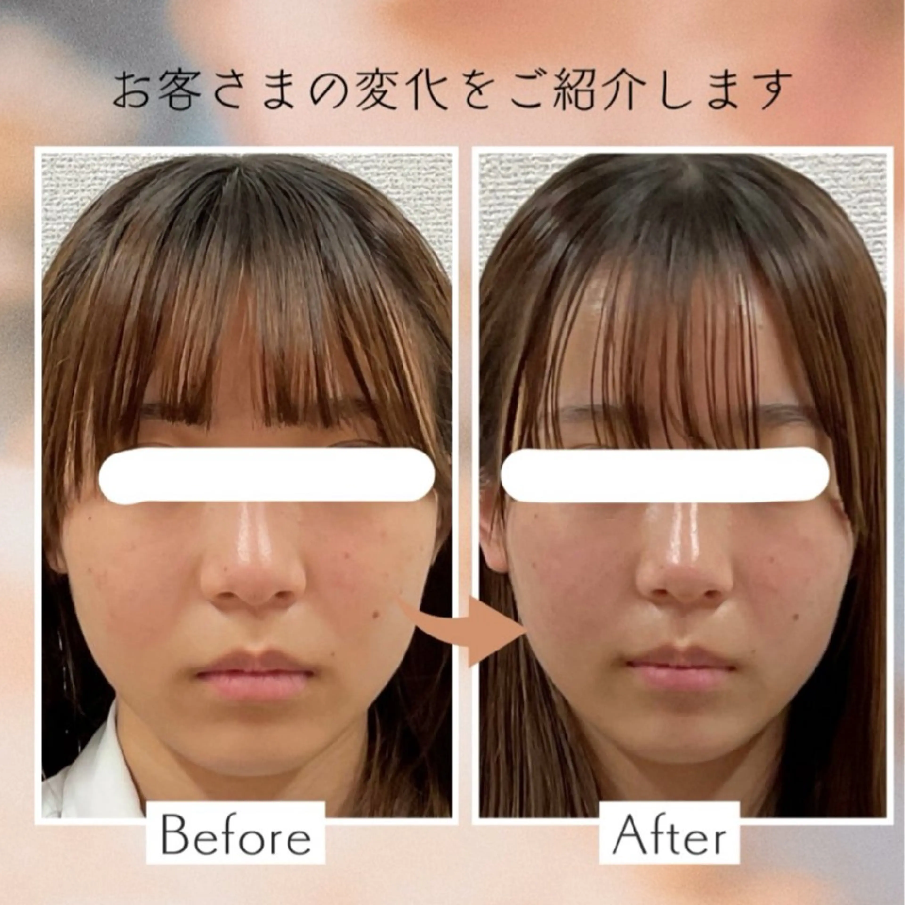 エステ 小顔矯正＆美肌サロン ブプラ大元駅前店のエステ・リラクイメージ