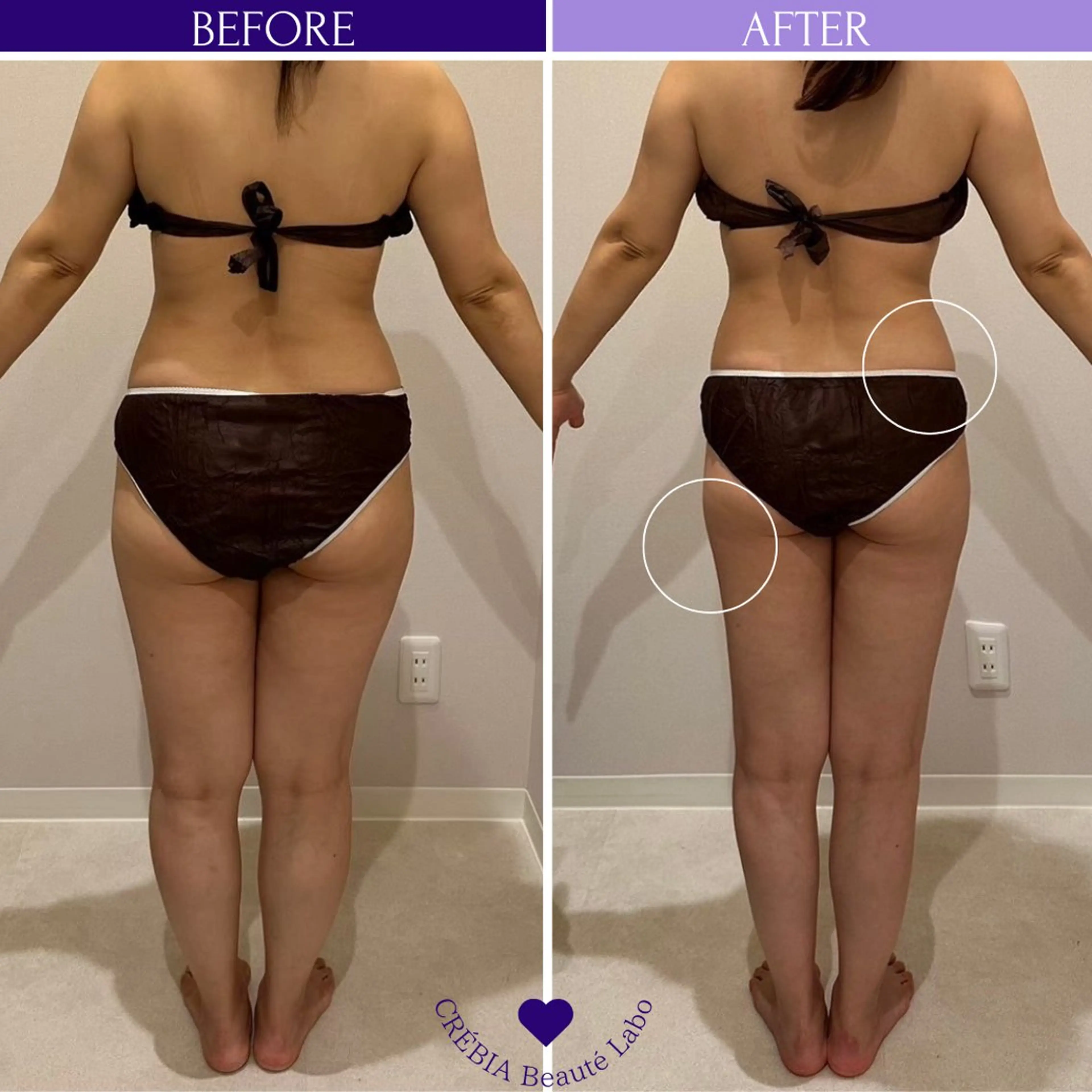 エステ リラク 小顔＆まつ毛サロン AKANE❤️のエステ・リラクイメージ