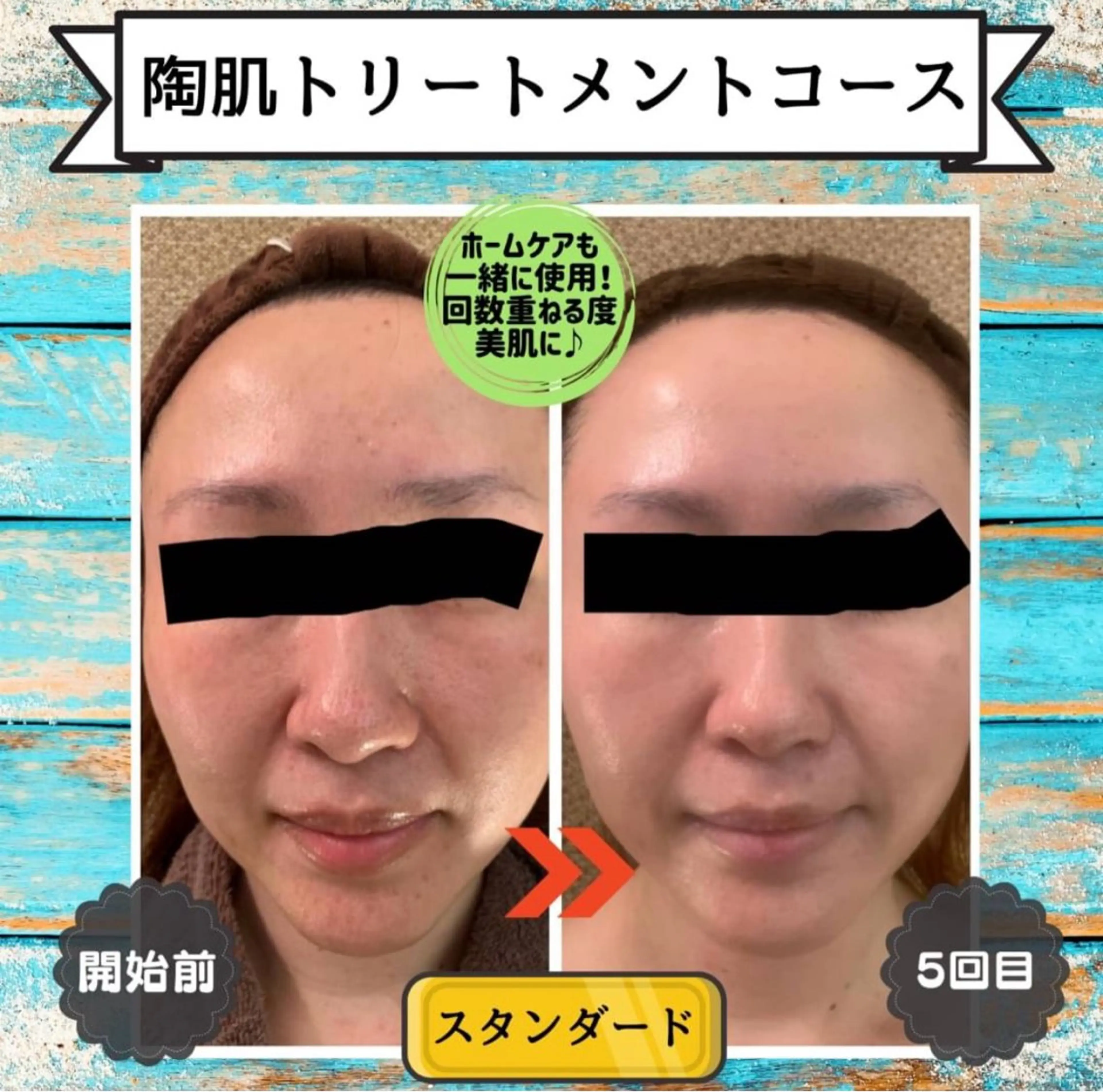 3/25迄ハーブ ピーリングBloomのエステ・リラクイメージ