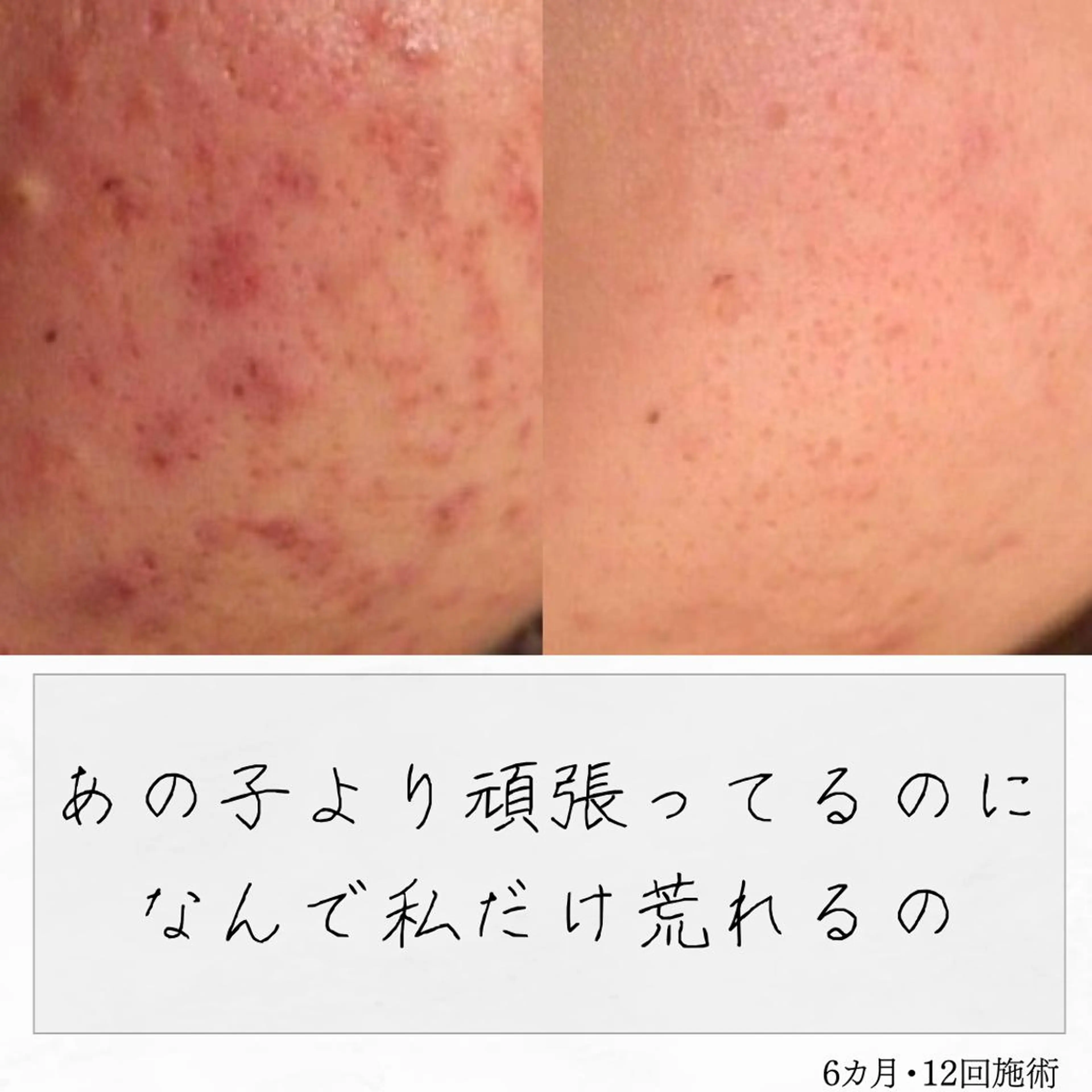 ニキビ経験者が施術 する専門サロン🌻のエステ・リラクイメージ