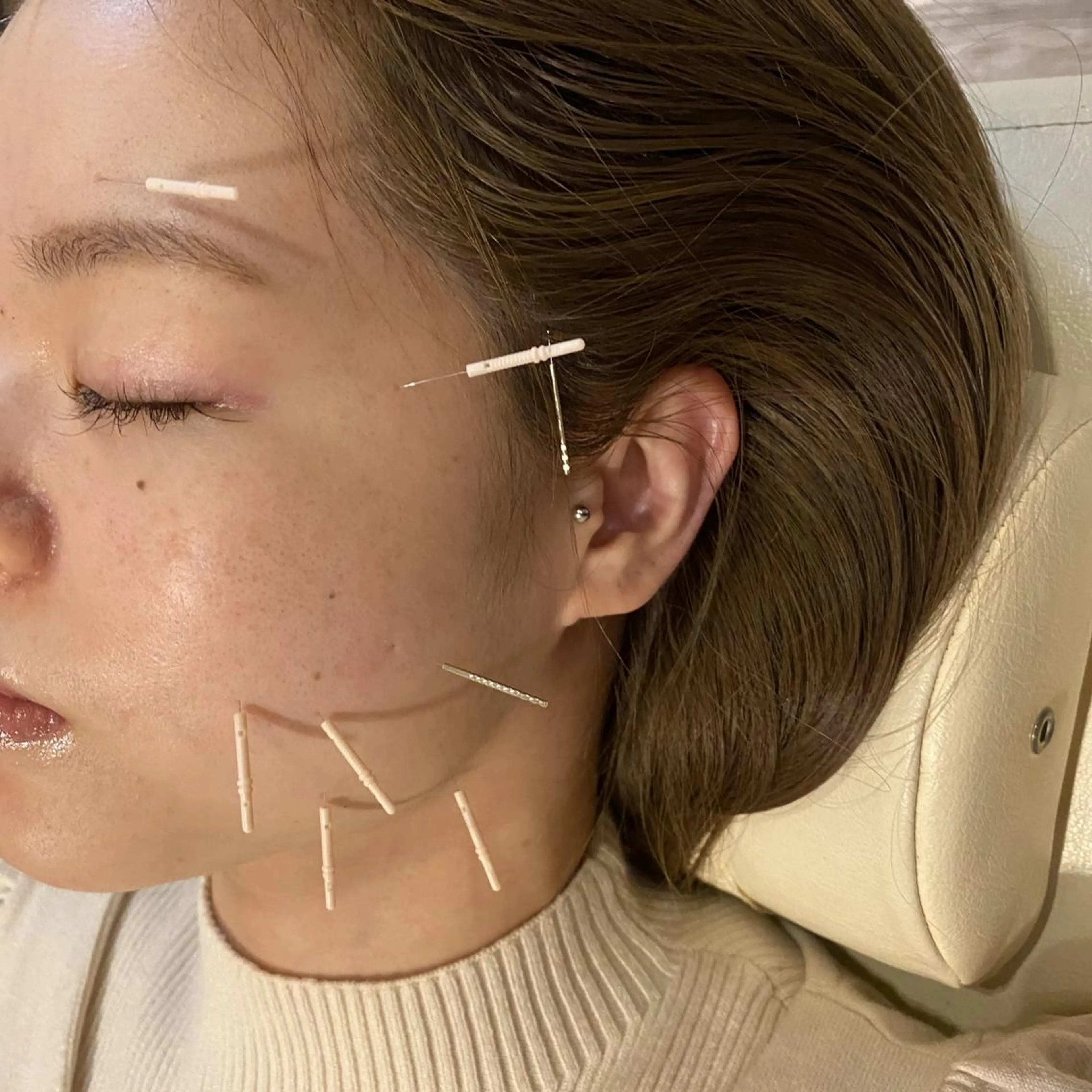 むくみたるみ専門☆ 美容鍼・小顔矯正のエステ・リラクイメージ