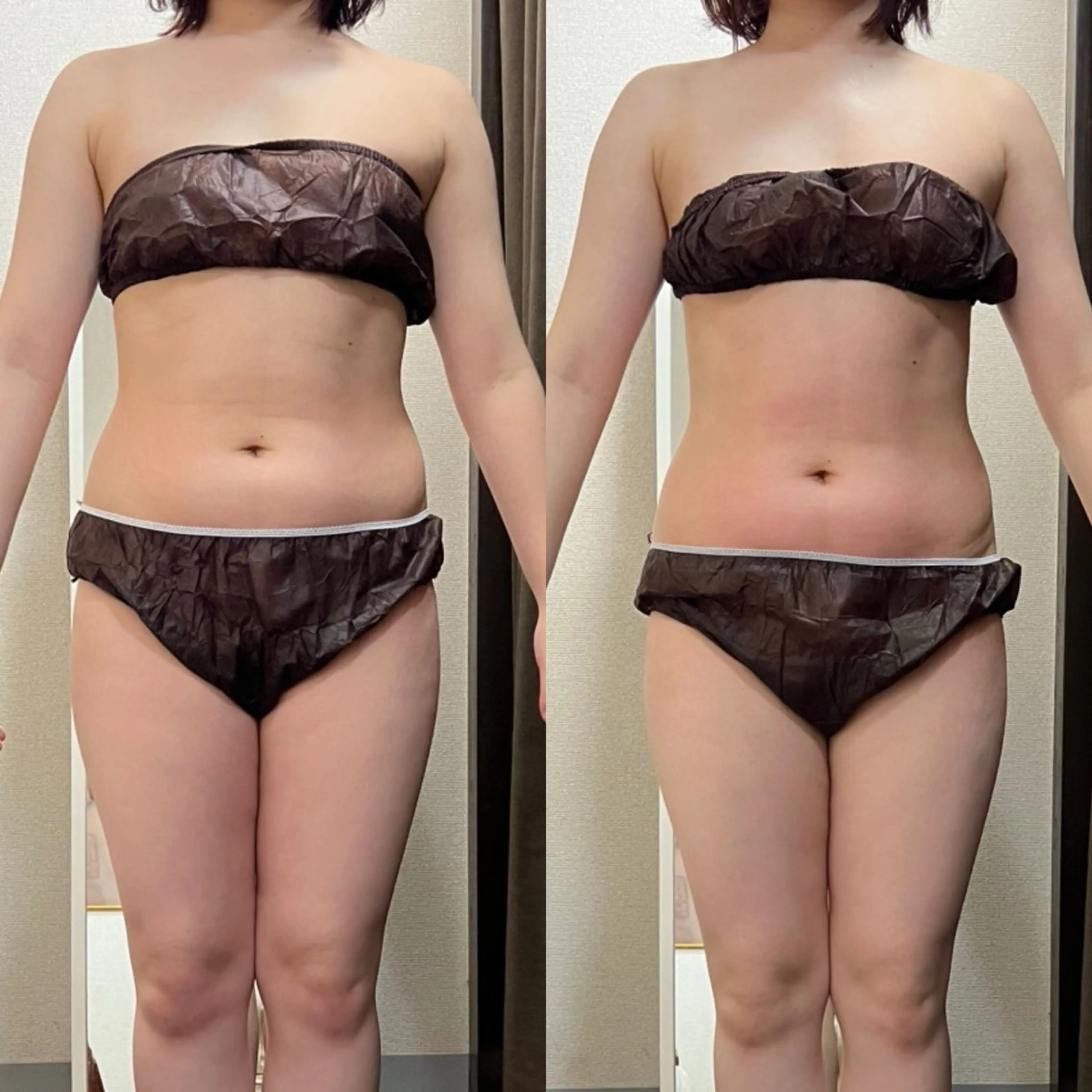 エステ ハイパーナイフ専門店　Salon de COCO所属・Salon de COCOのエステ・リラクイメージ