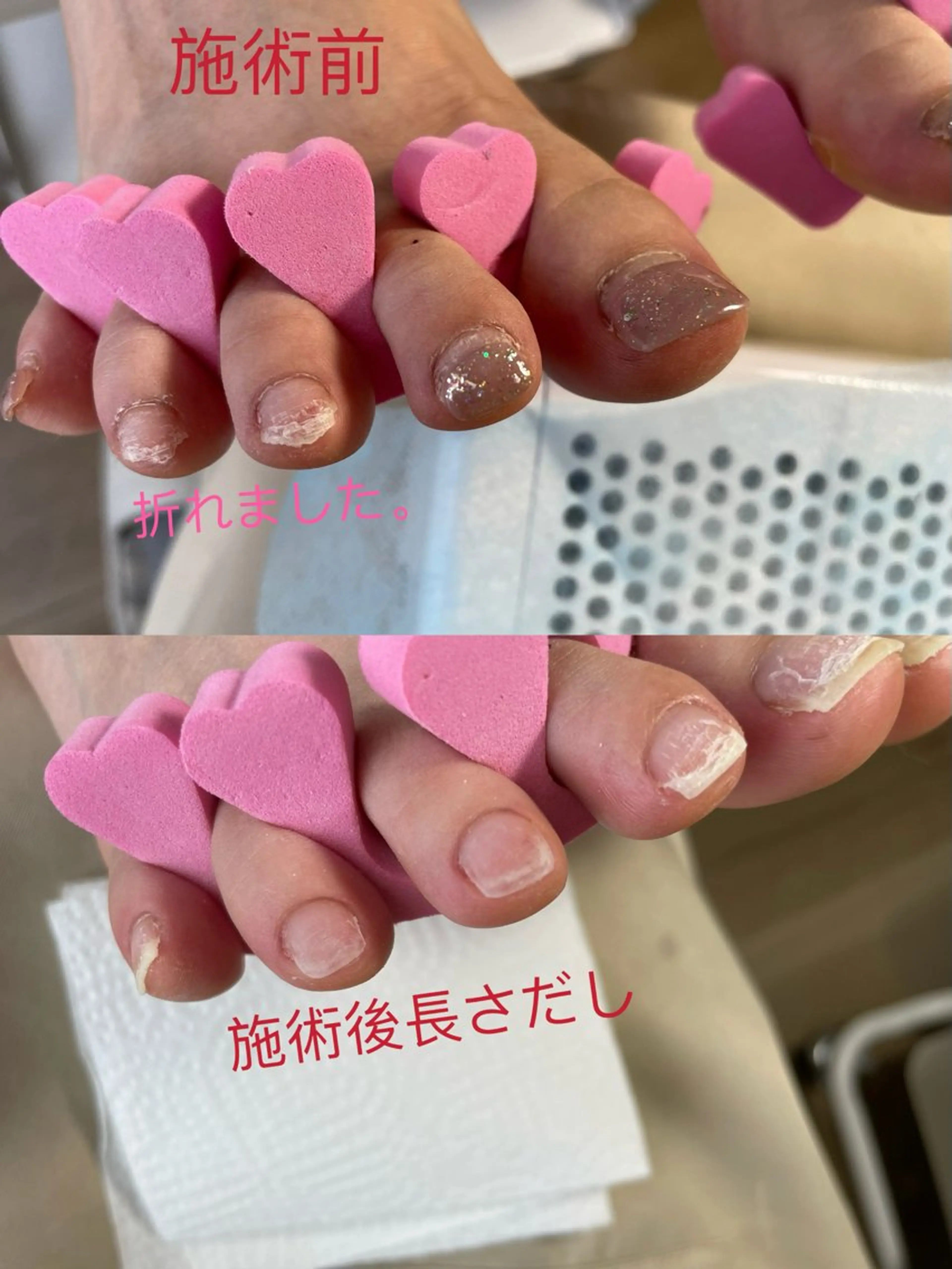 ネイル フットネイル Ai Nailのネイルデザイン