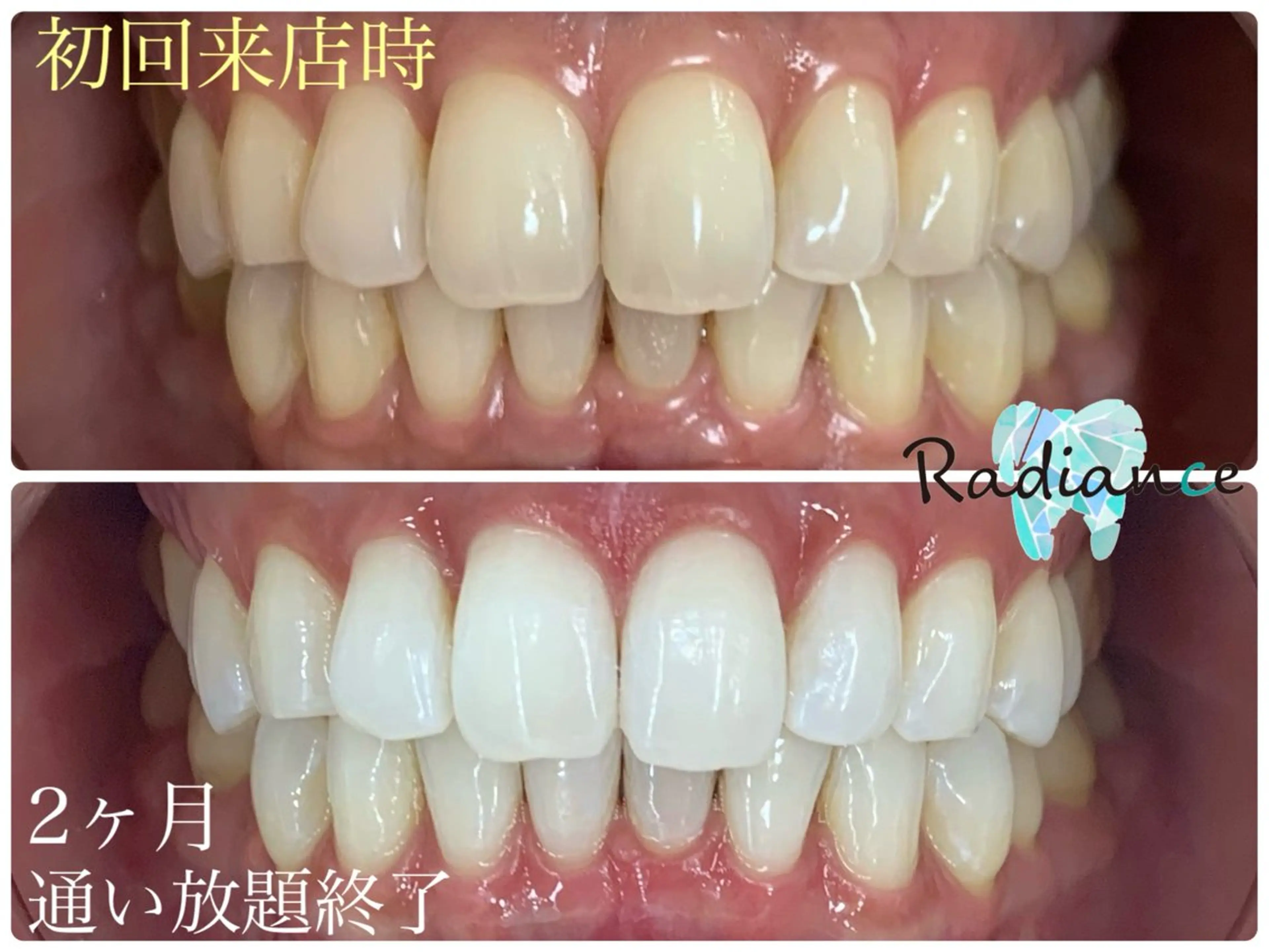 札幌ホワイトニング ラディアンス札幌駅店のその他イメージ