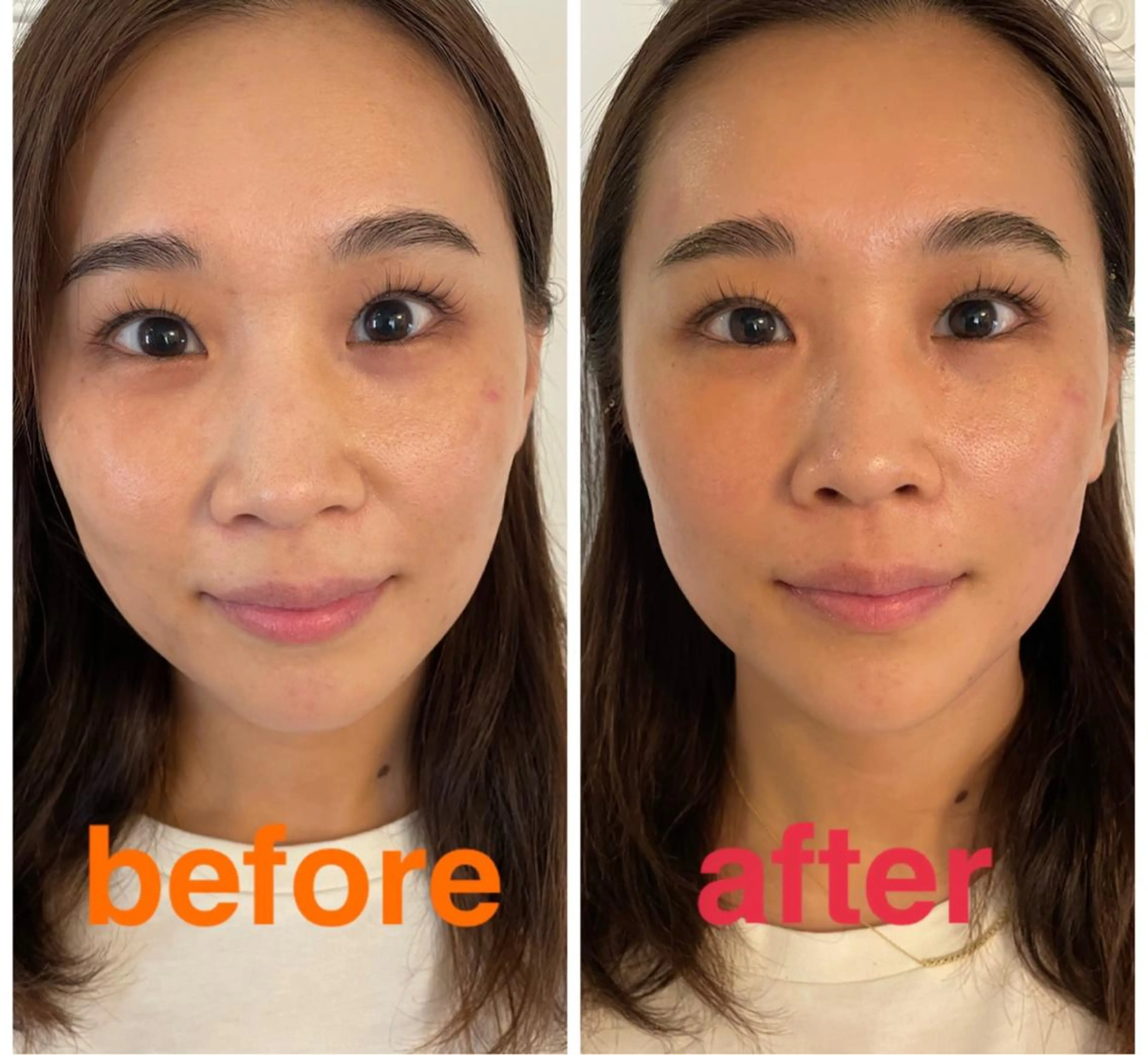 美容鍼灸サロン mahoroba院長のエステ・リラクイメージ