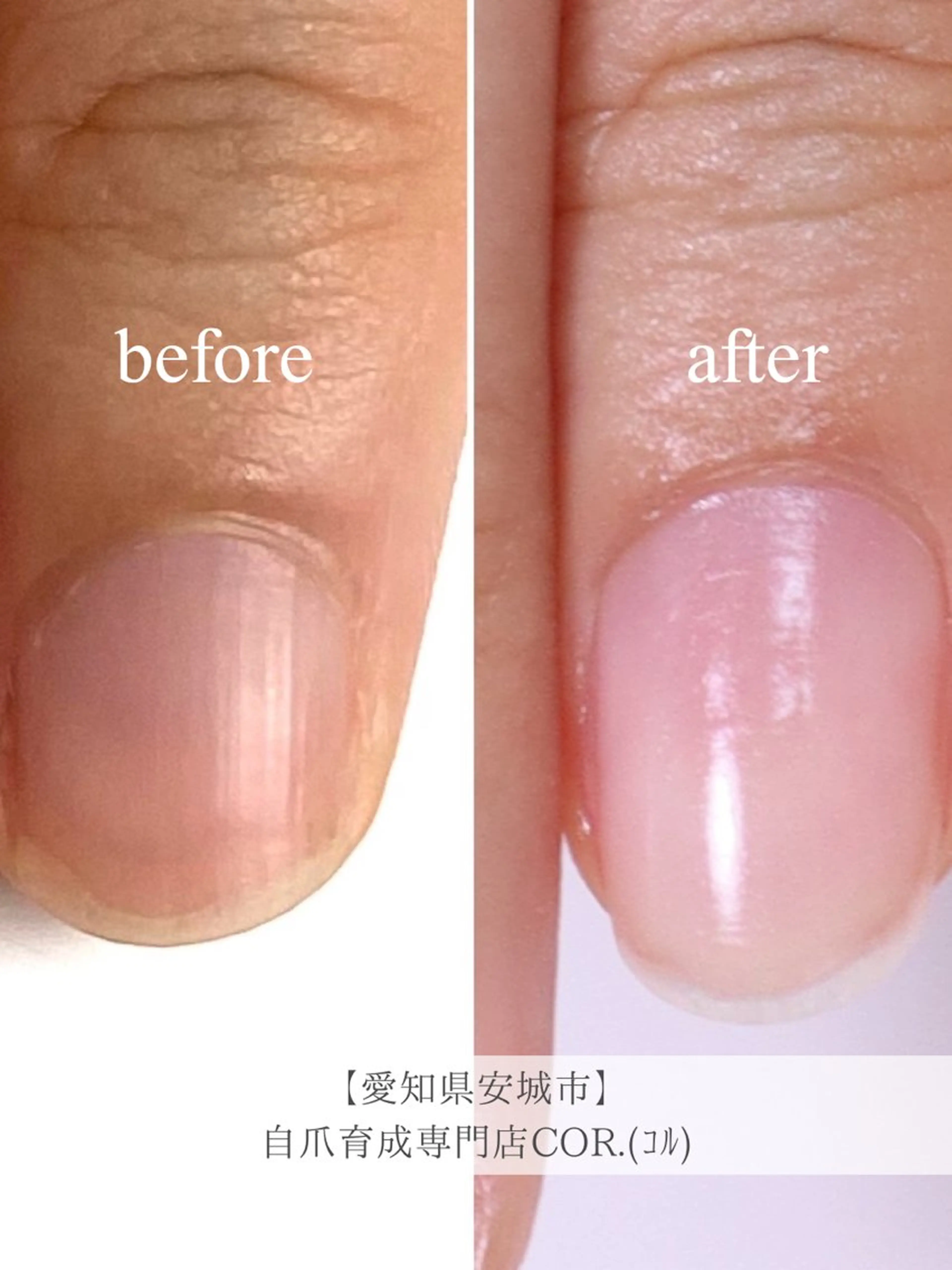 自爪育成ネイル【2000円相当のネイルオイル付き🎁】自爪育成の詳細は▷@cor._privatenailsalonの写真