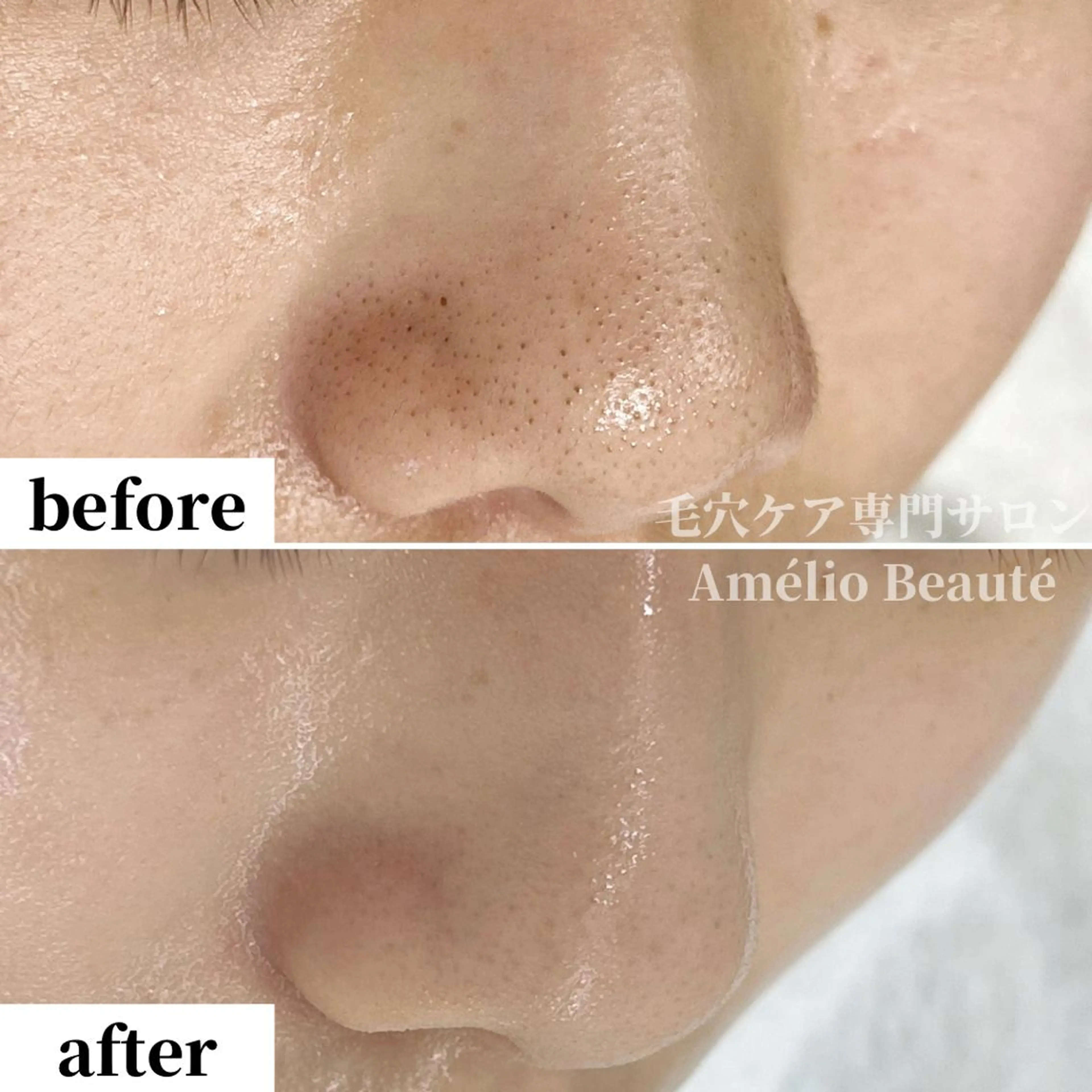 毛穴ケア専門サロン アメリオボーテのその他イメージ