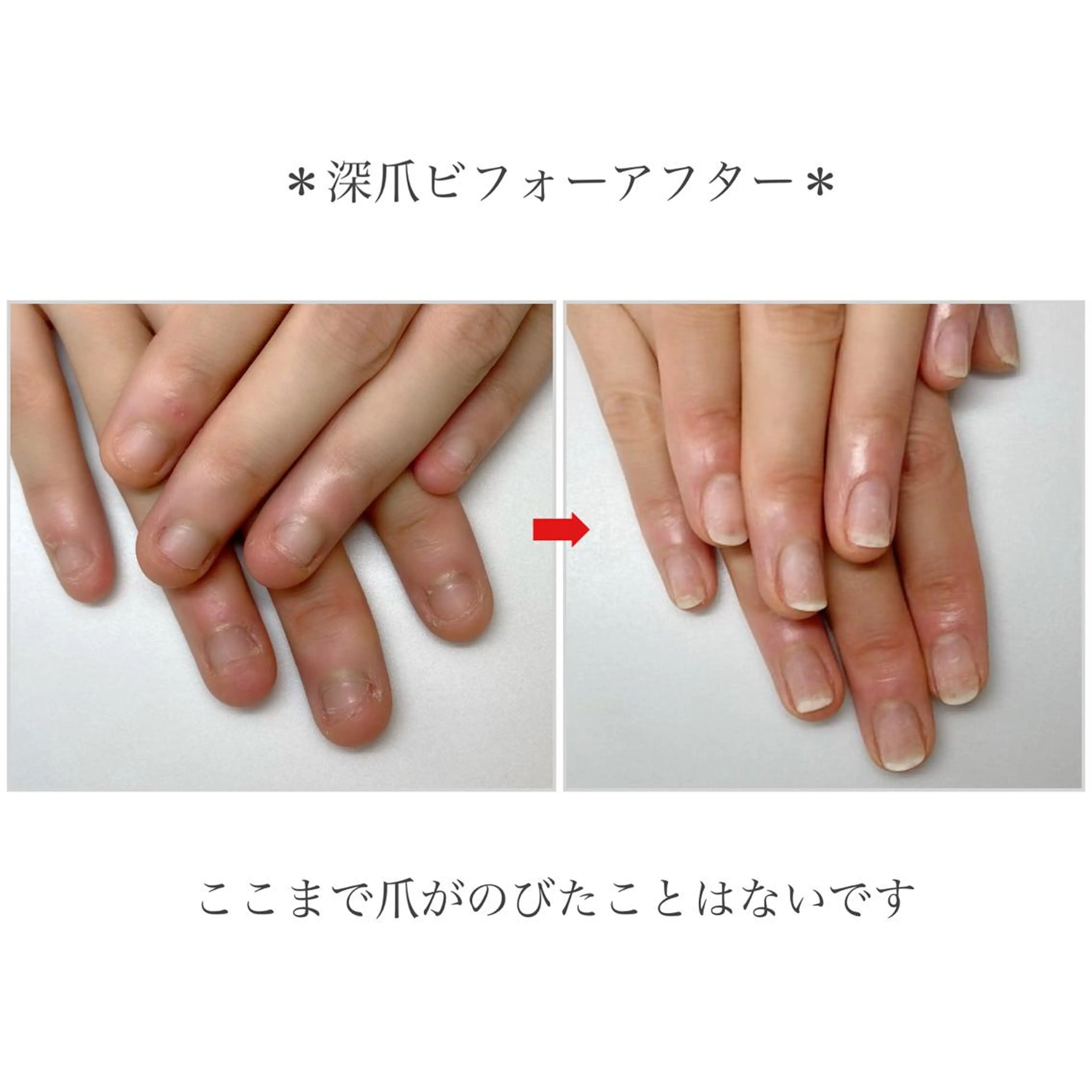 ネイル ネイルサロン アリュームのネイルデザイン