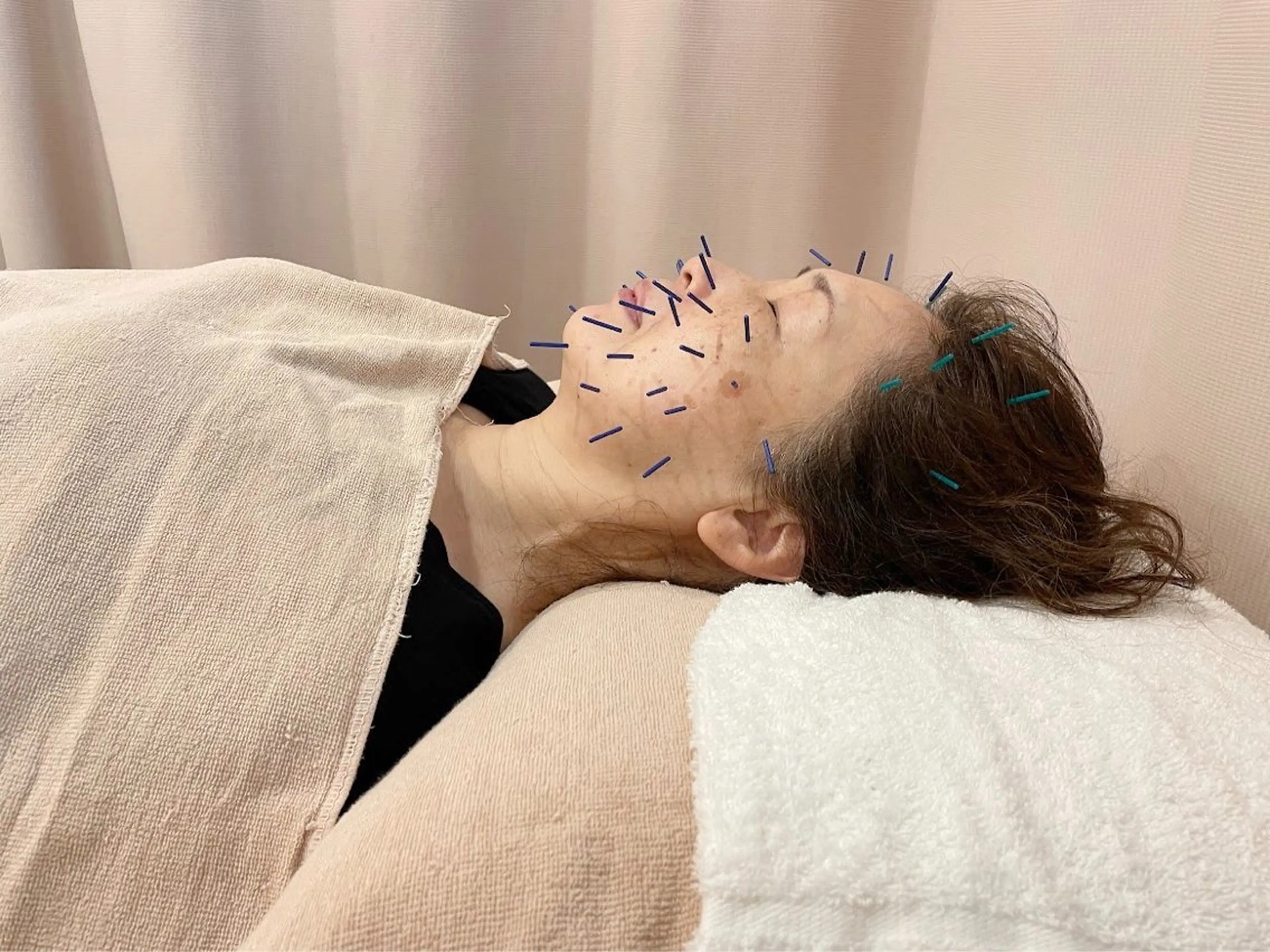 こじま富雄団地 接骨院のその他イメージ