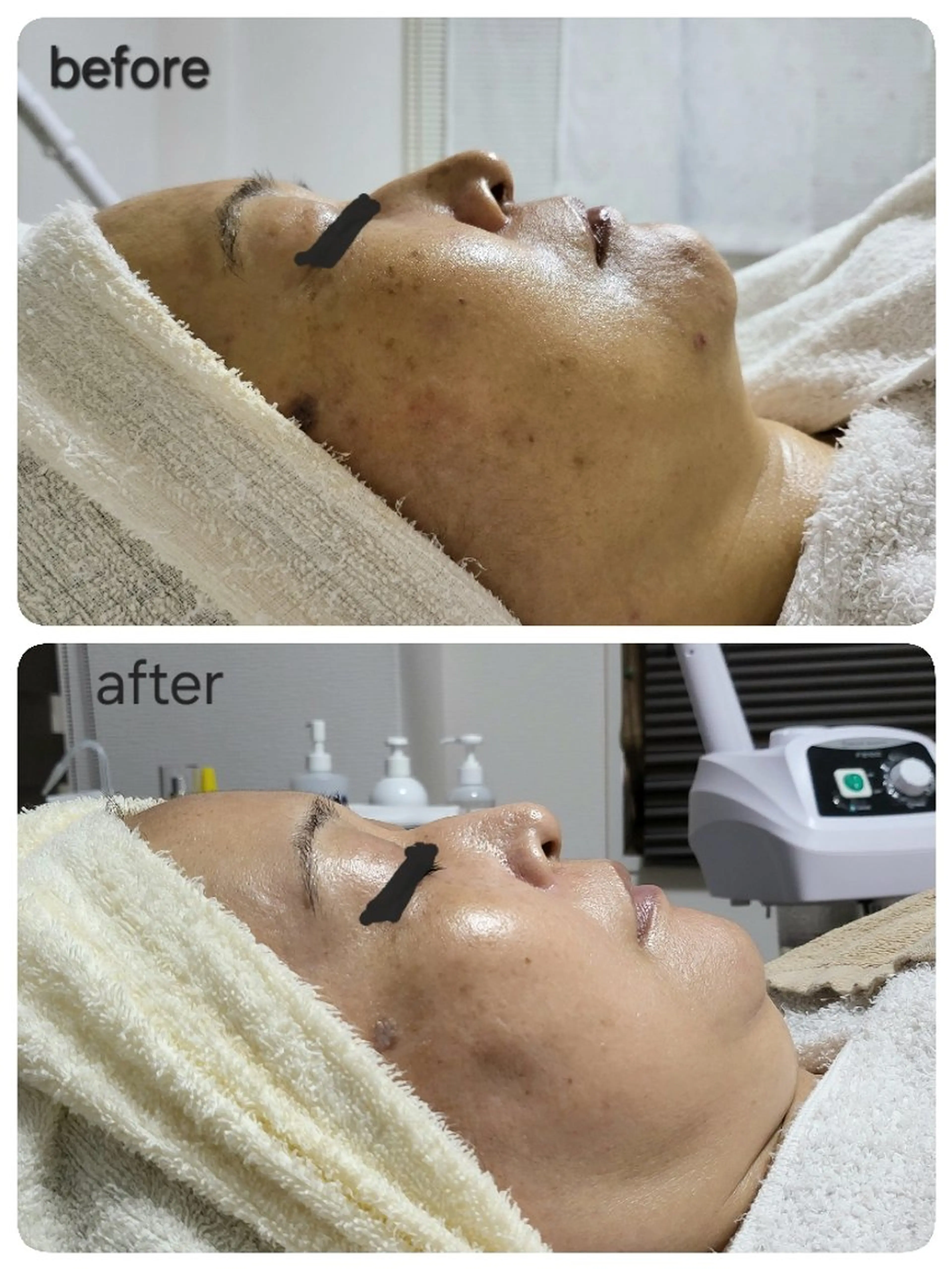 エステ ニキビ・ニキビ跡専門 レゾン京橋店　のエステ・リラクイメージ