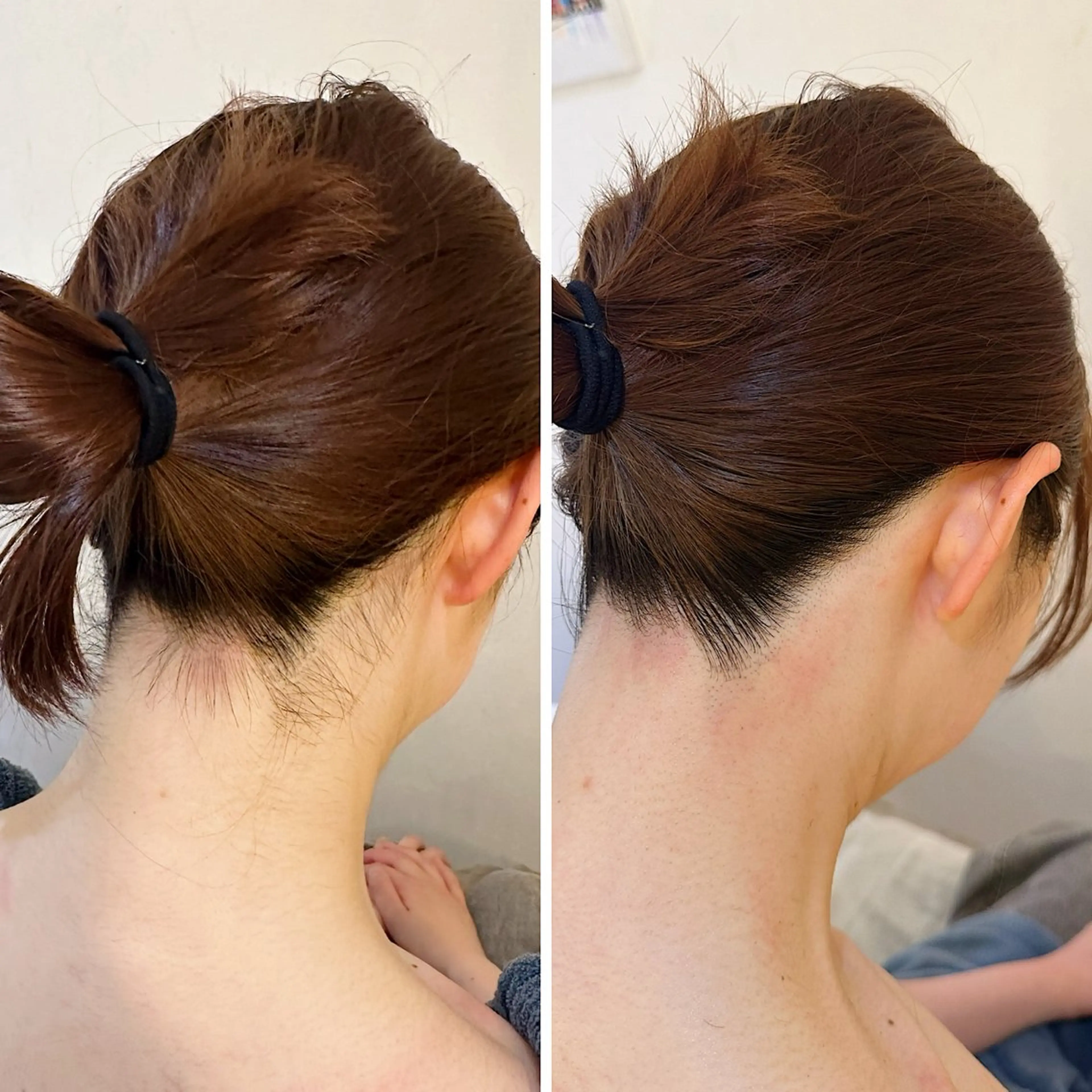 脱毛 うなじ脱毛/美肌脱毛 LABELのエステ・リラクイメージ