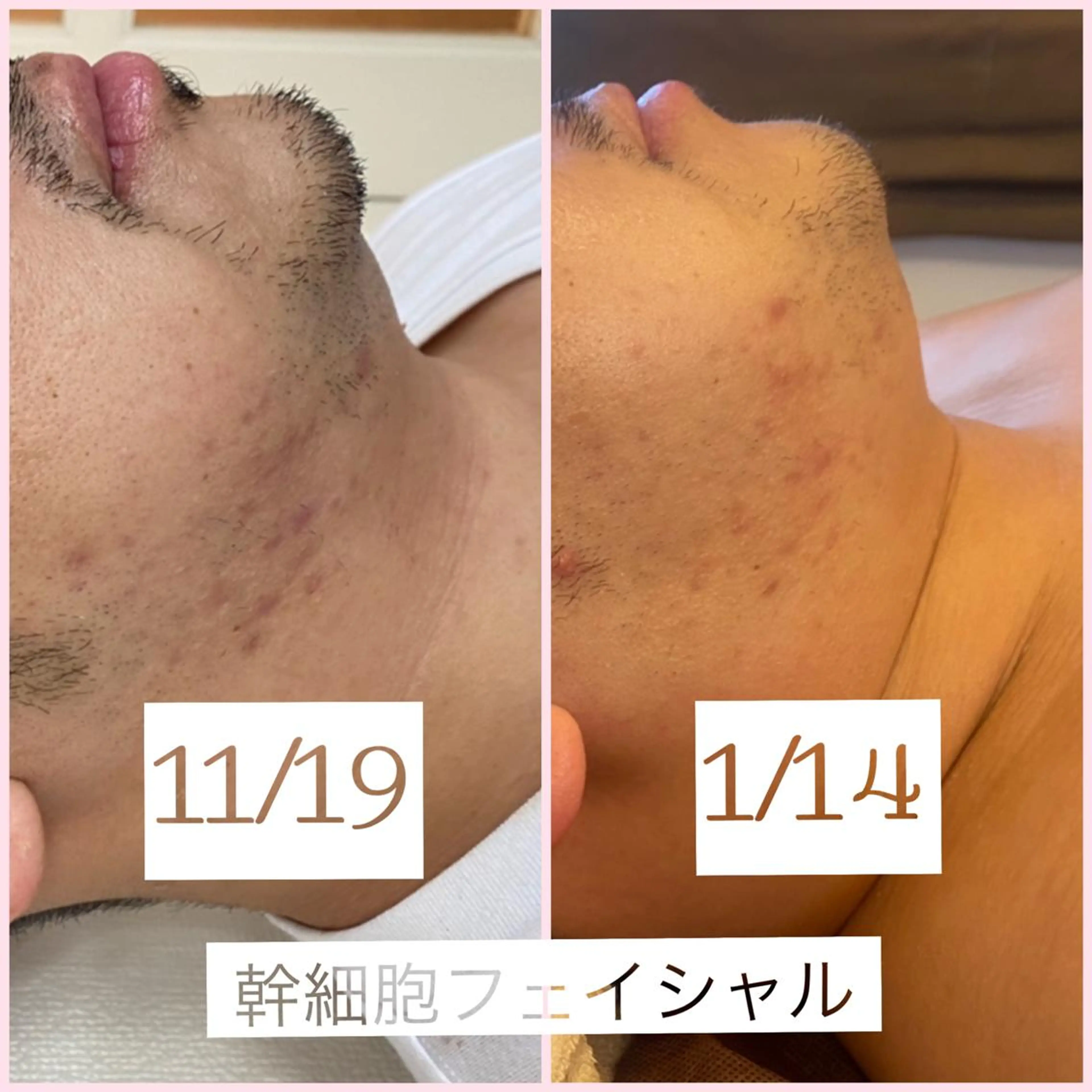 プルケル スパのエステ・リラクイメージ