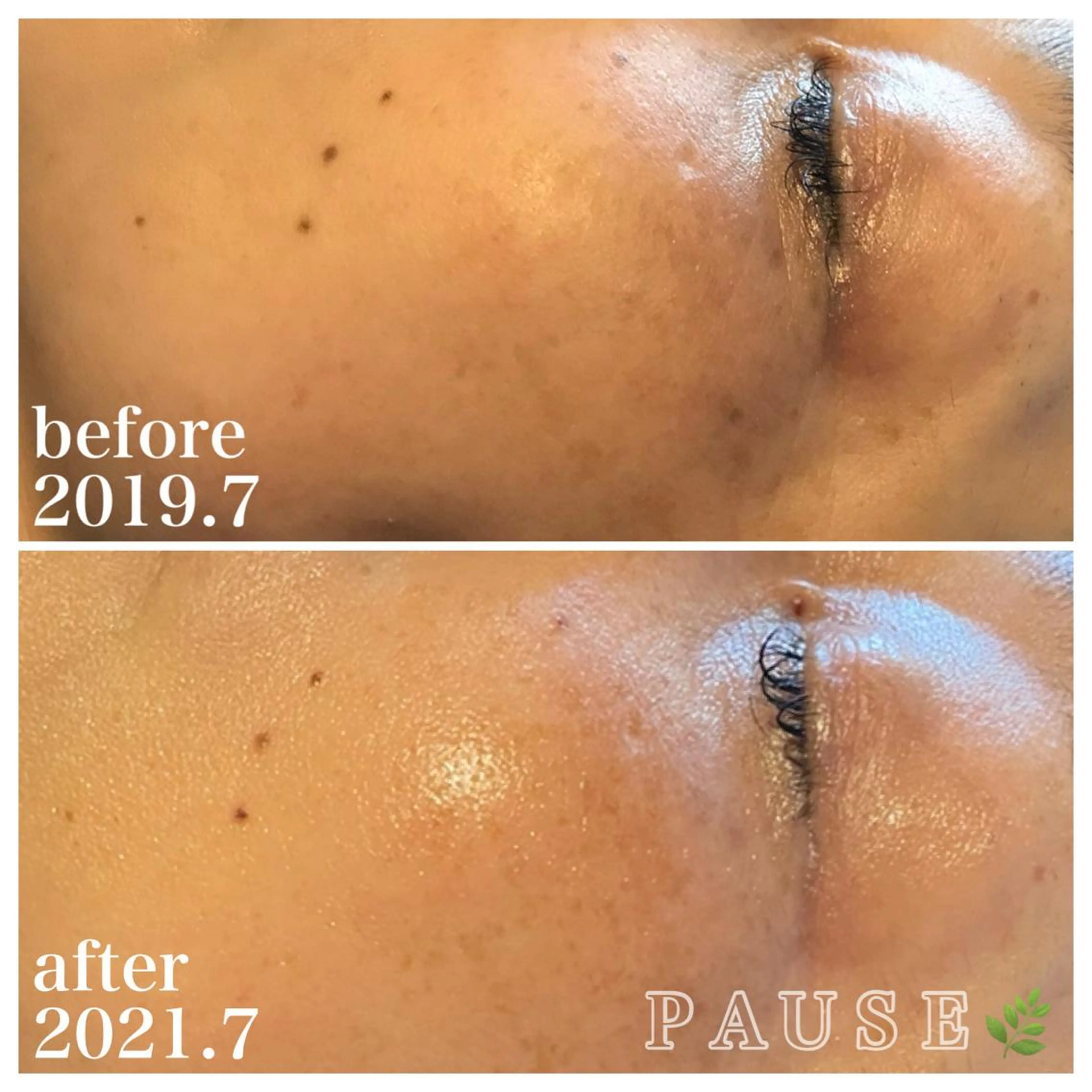 エステ 浜野 恵美のエステ・リラクイメージ