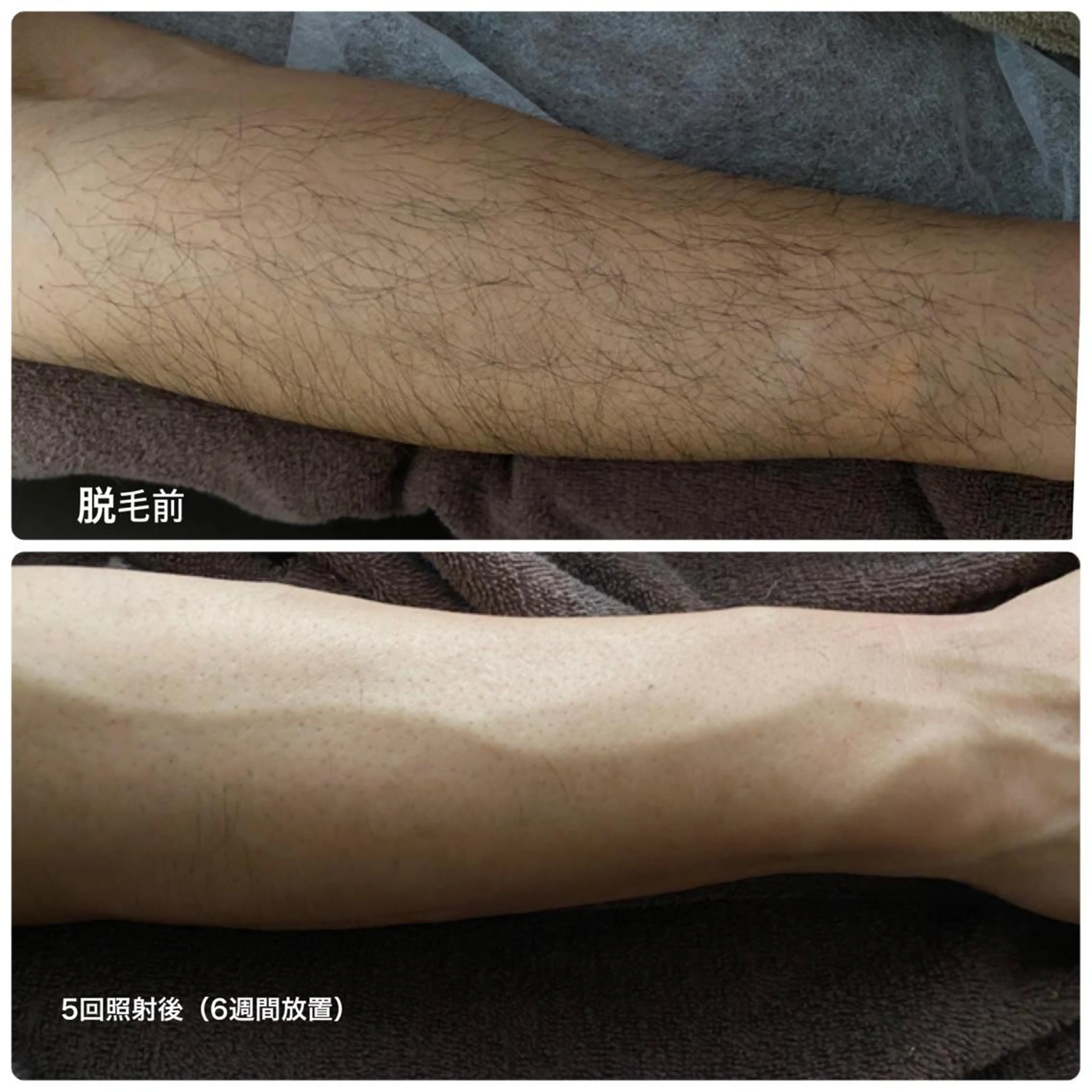 メンズ メンズ脱毛 ゼロのエステ・リラクイメージ