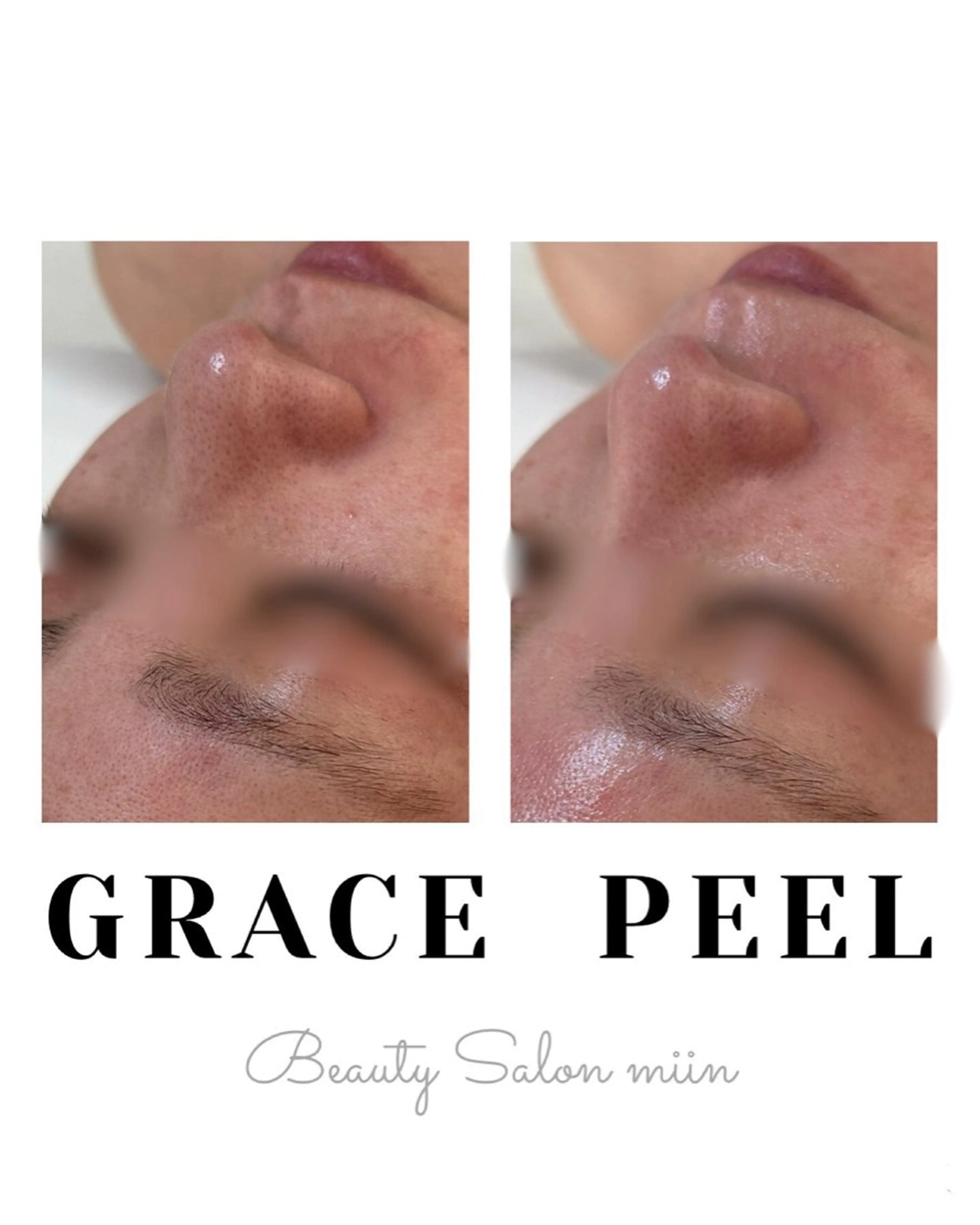 エステ 韓国肌管理 白玉肌管理®︎のエステ・リラクイメージ