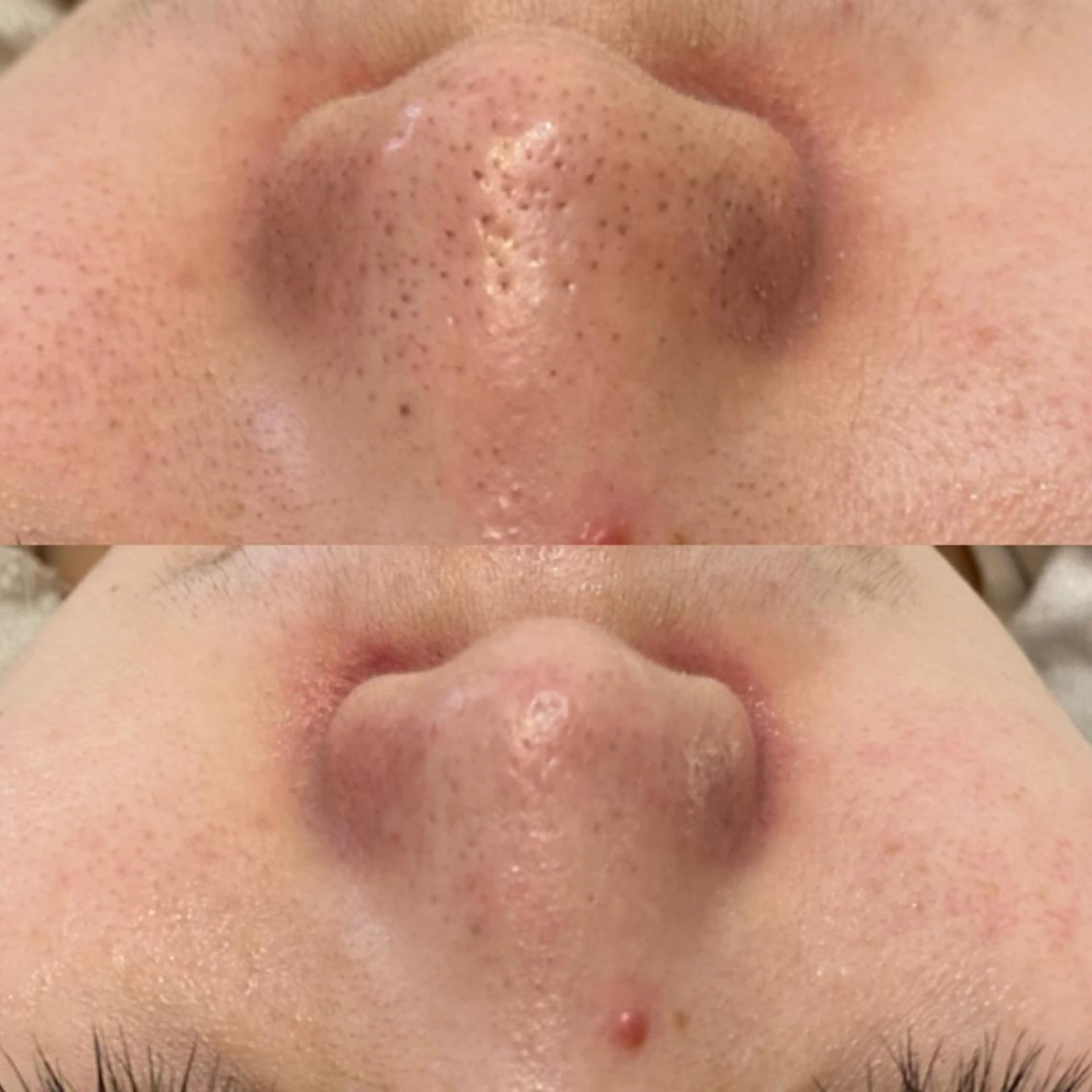 エステ ララ/ハーブ メゾンリュバンのエステ・リラクイメージ