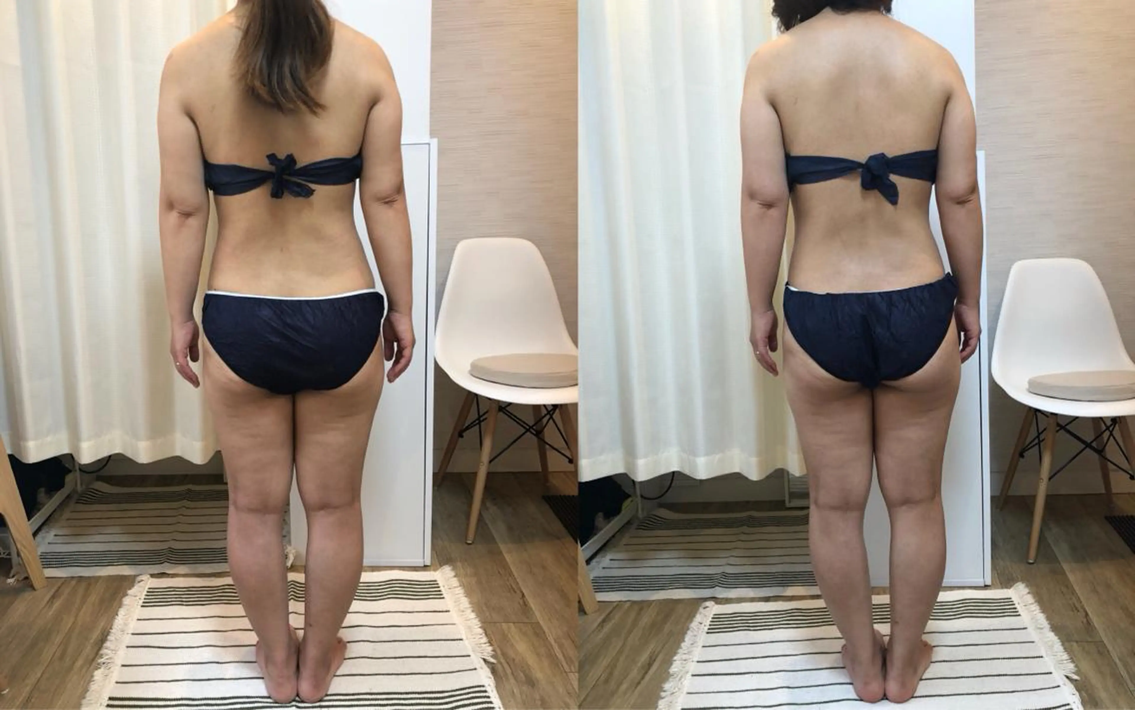 ROOM.S ｜脱毛｜美肌｜ボディのエステ・リラクイメージ