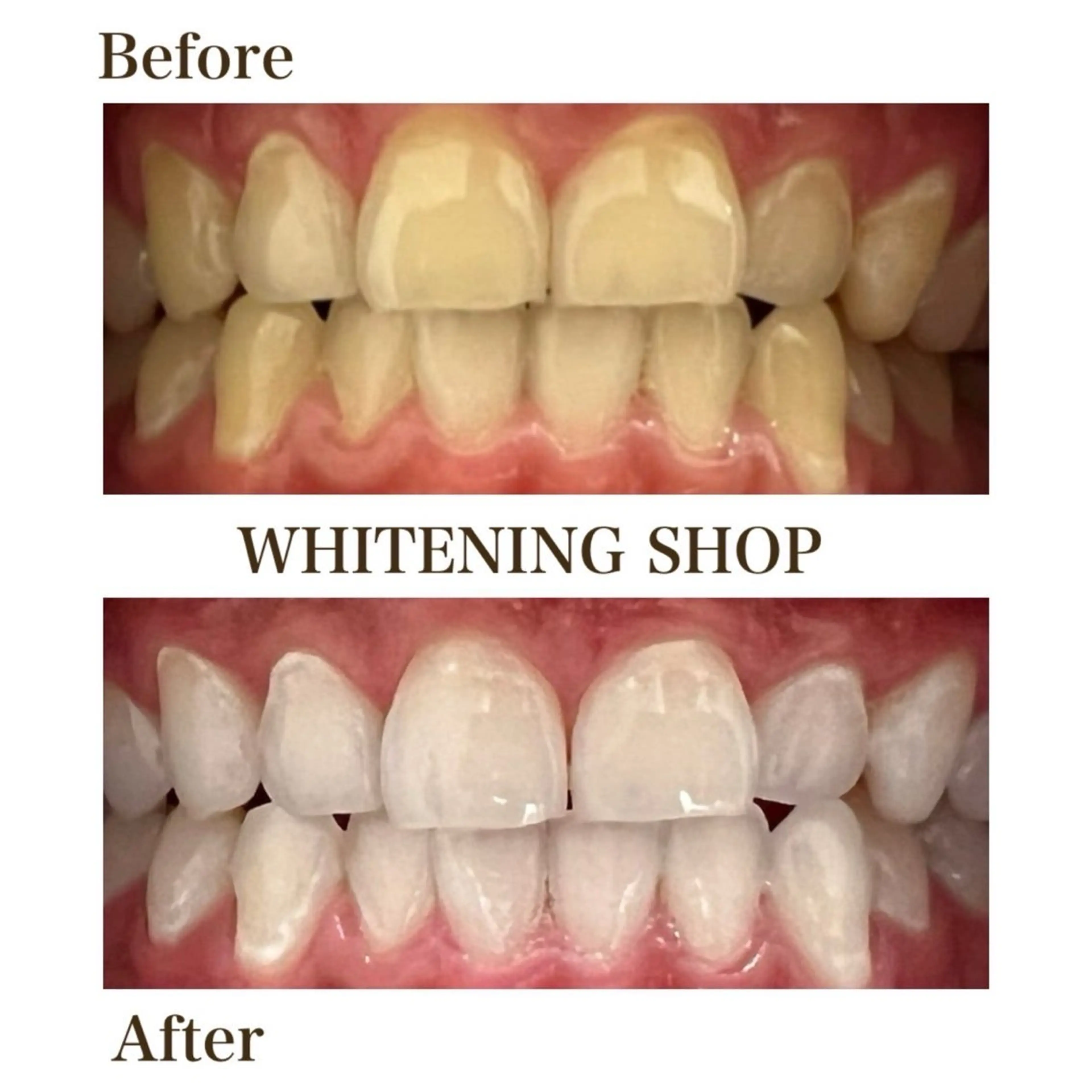 メンズ ホワイトニング ショップ葵区静岡駅店のその他イメージ