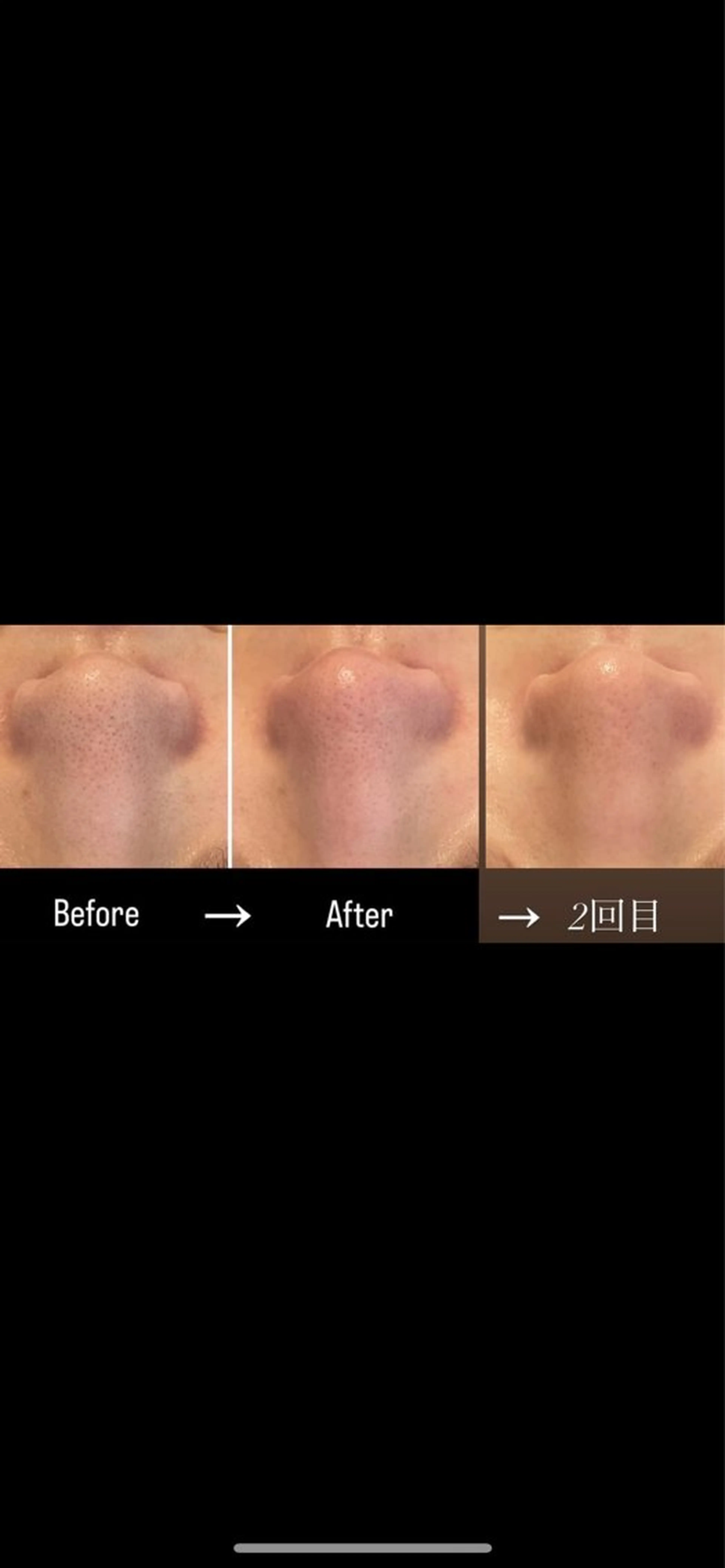 ニキビ/疲労回復ケア シェソワのエステ・リラクイメージ