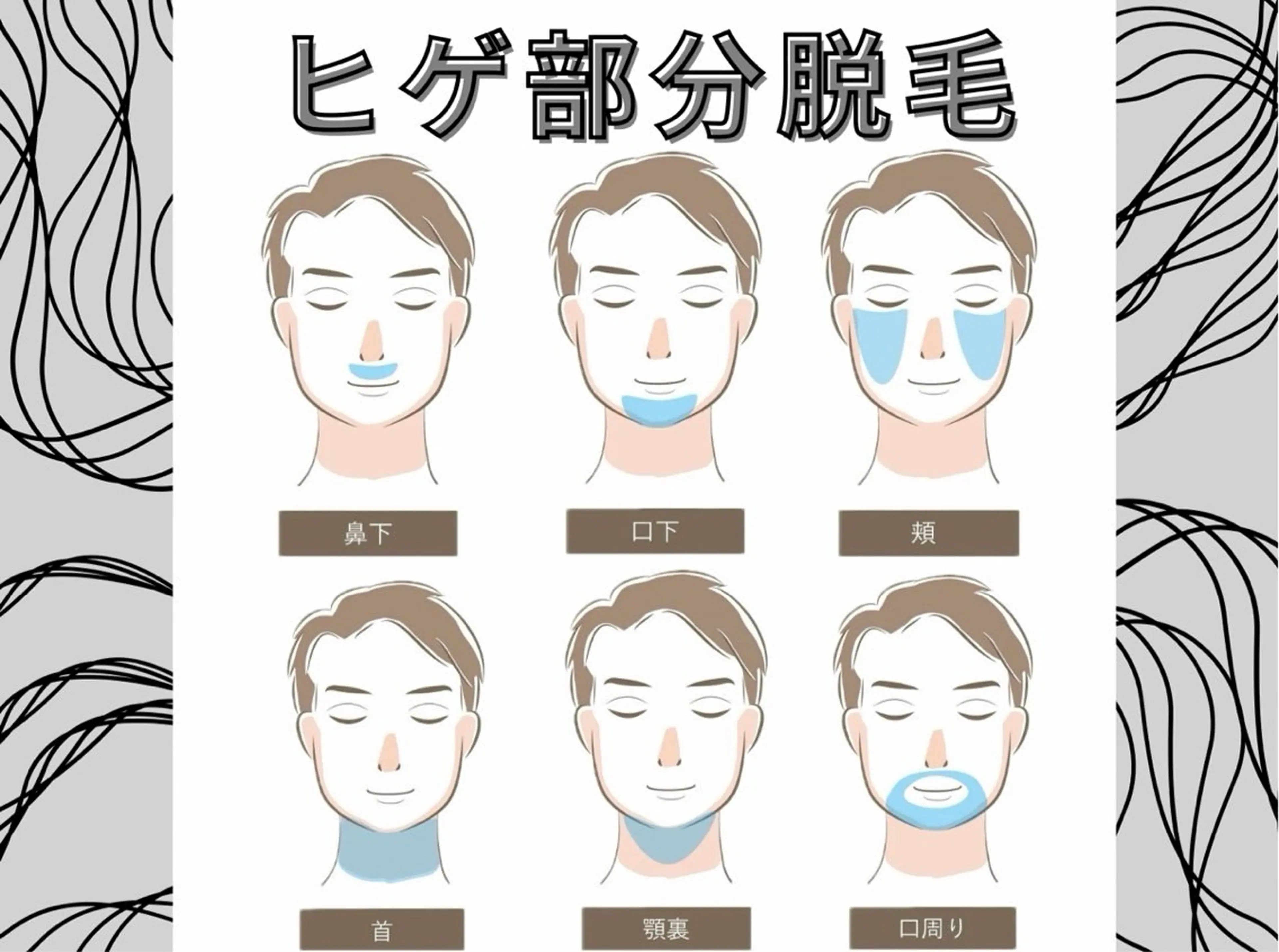 メンズ髭脱毛■1箇所（鼻下／口下／頬／首／顎)の写真