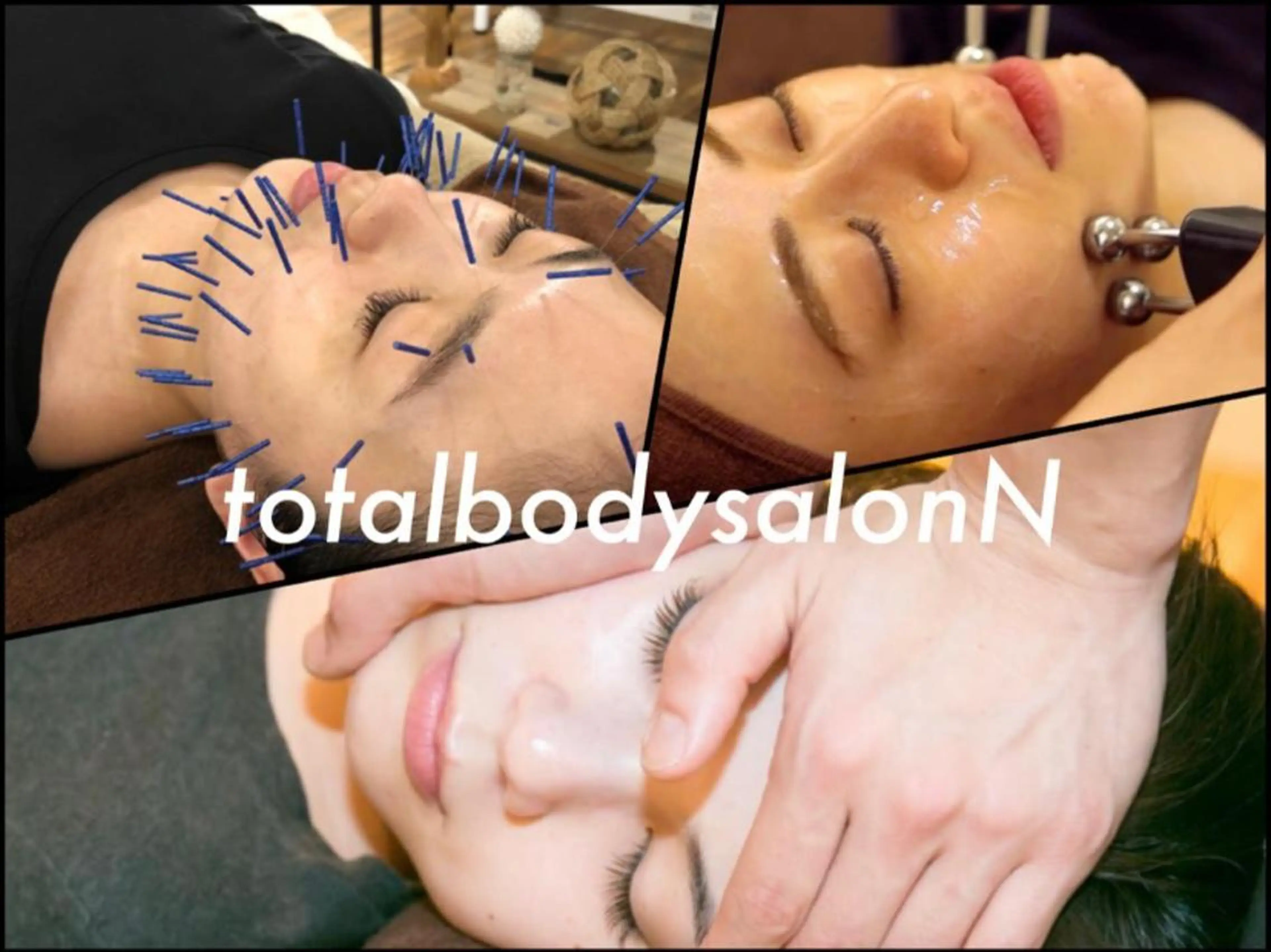 【N式 究極小顔3セット】初回45%off《小顔矯正×小顔EMS×美容鍼(120分)25,300円→14,500円》の写真