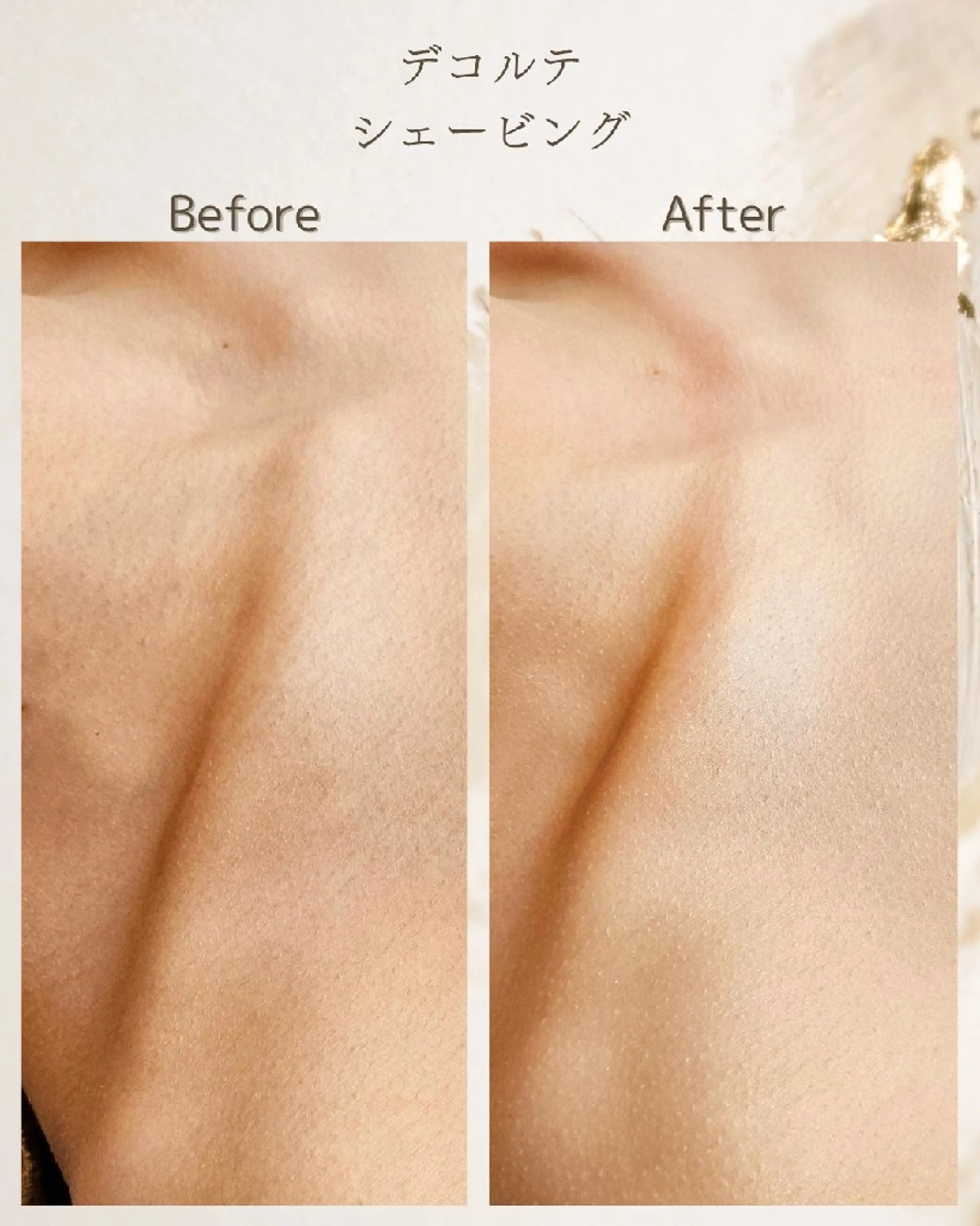 エステ シェービングサロン アンダブル/鴨井のその他イメージ