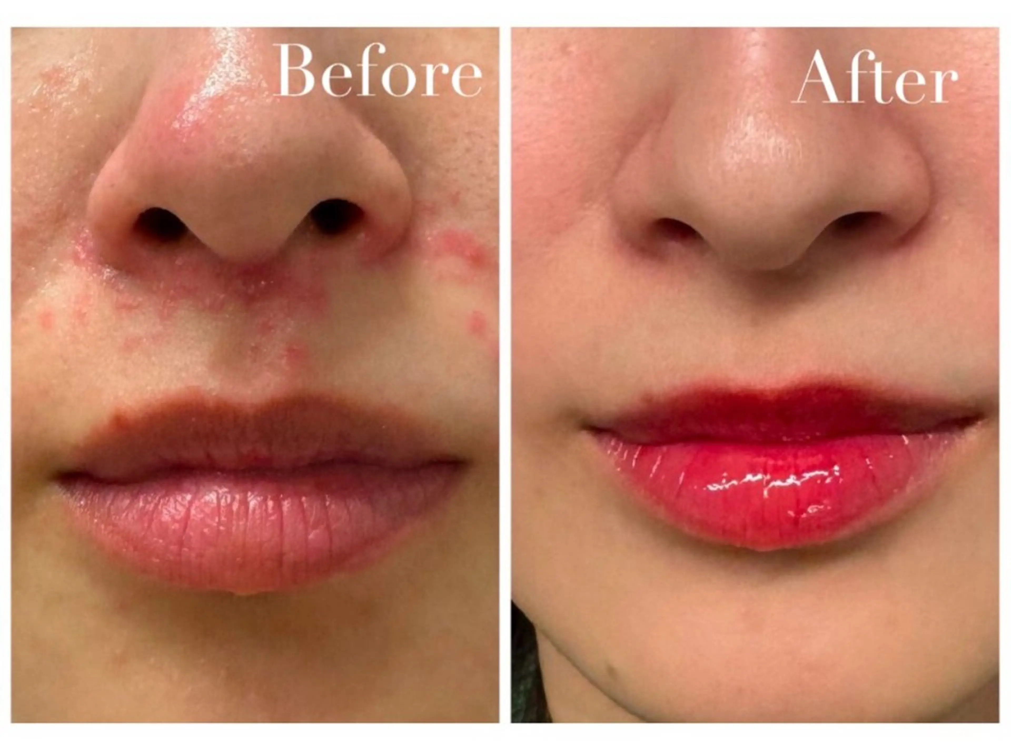 エステ Avenir Brillant所属・松田 紗季のエステ・リラクイメージ