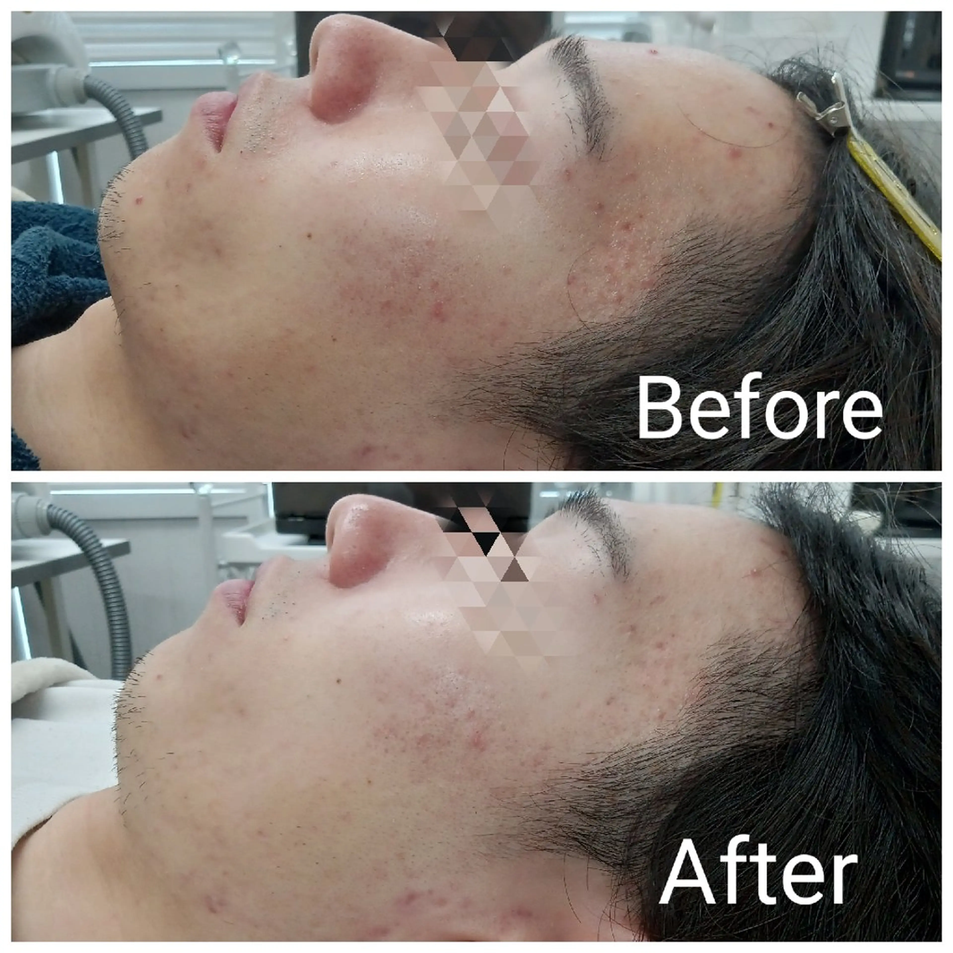 エステ リラク 肌質改善Beauty salon Renのエステ・リラクイメージ