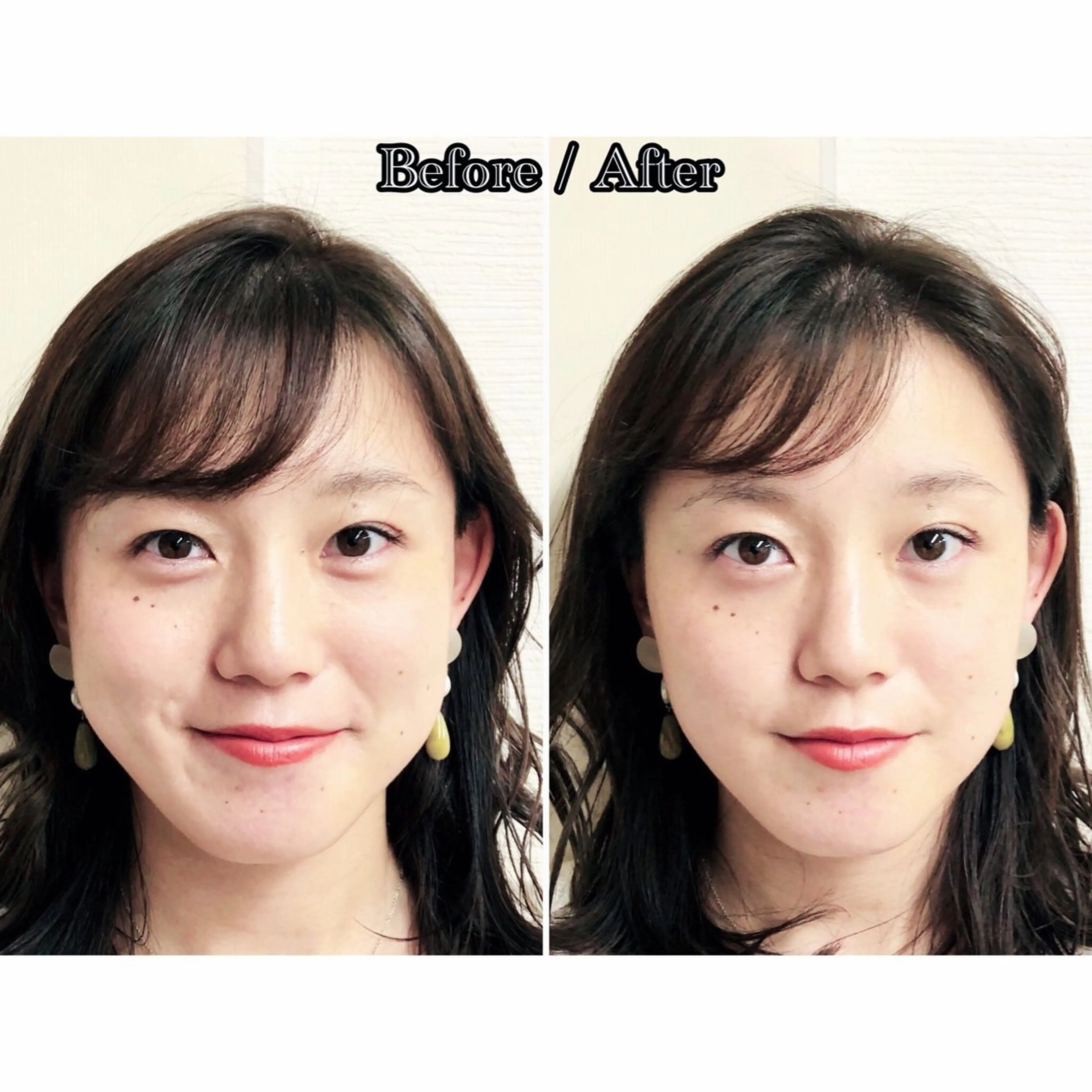 エステ リラク 渋谷 小顔美容鍼 専門サロン YZのエステ・リラクイメージ